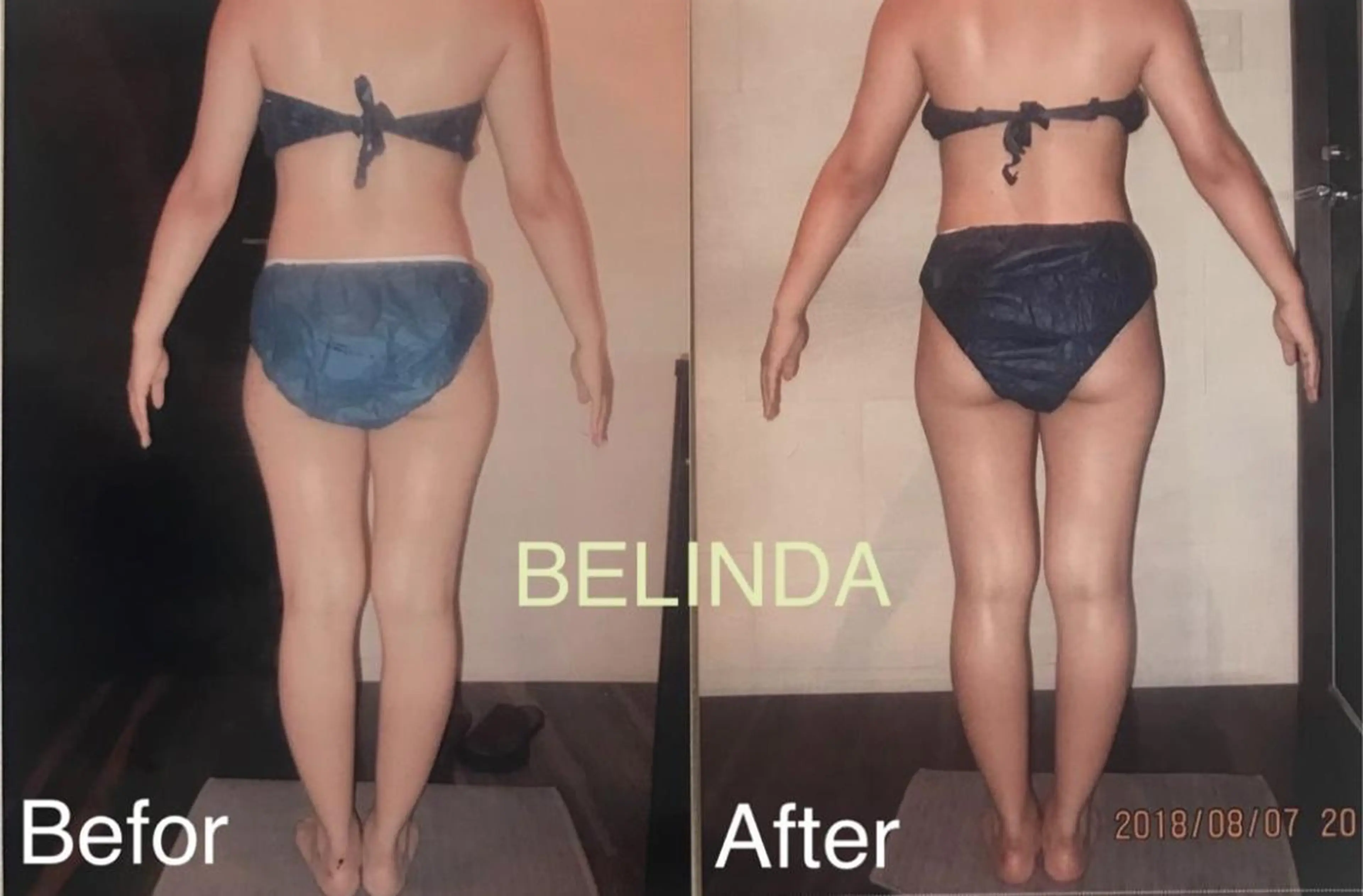 エステ BELINDA銀座店 ✨痩身エステサロン✨のエステ・リラクイメージ