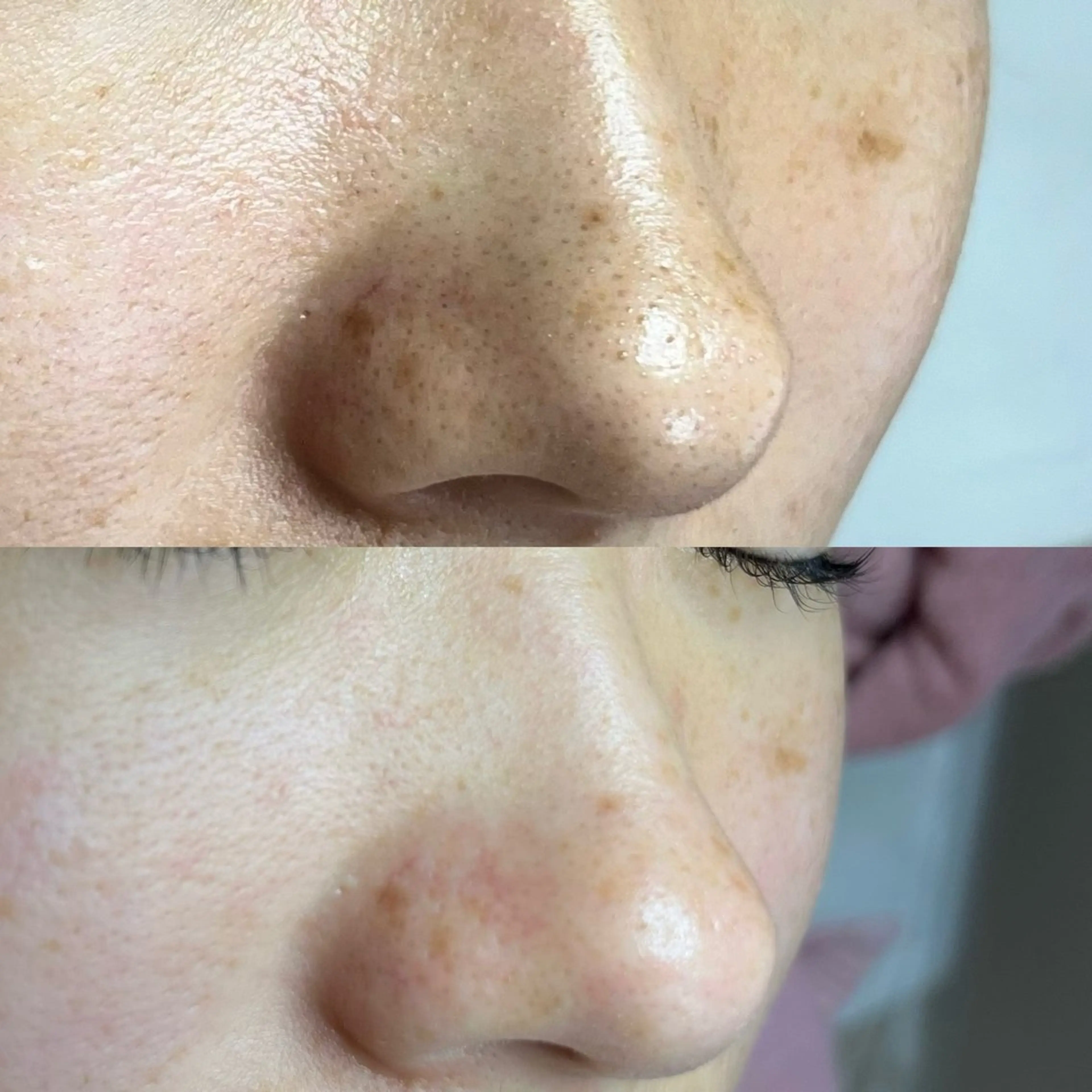 毛穴ケア・ヘッドスパサロンSHINY(シャイニー)所属・毛穴ケア・ヘッドスパ サロンSHINYのエステ・リラクイメージ