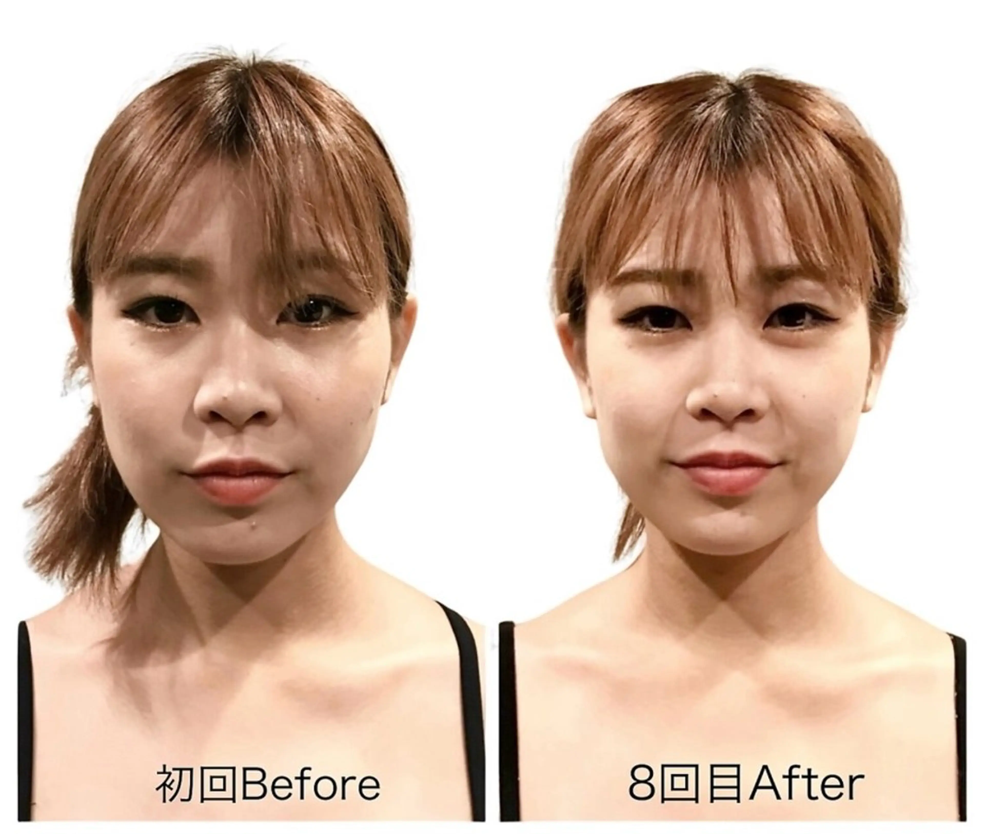 小顔•美容矯正Bholic所属・小顔・骨格矯正 Bholic 日本橋のエステ・リラクイメージ