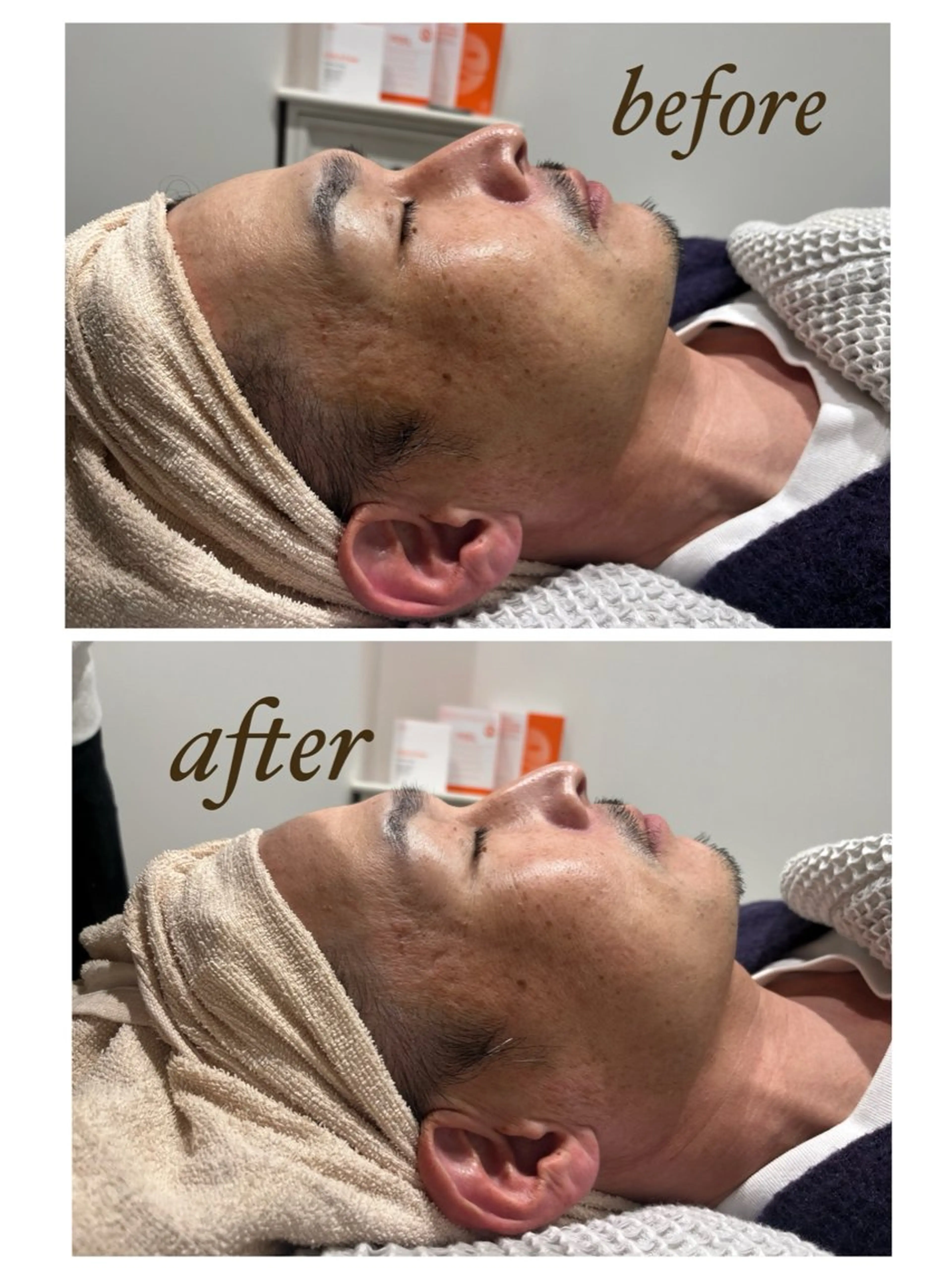 エステ 柳川 瑠花のエステ・リラクイメージ