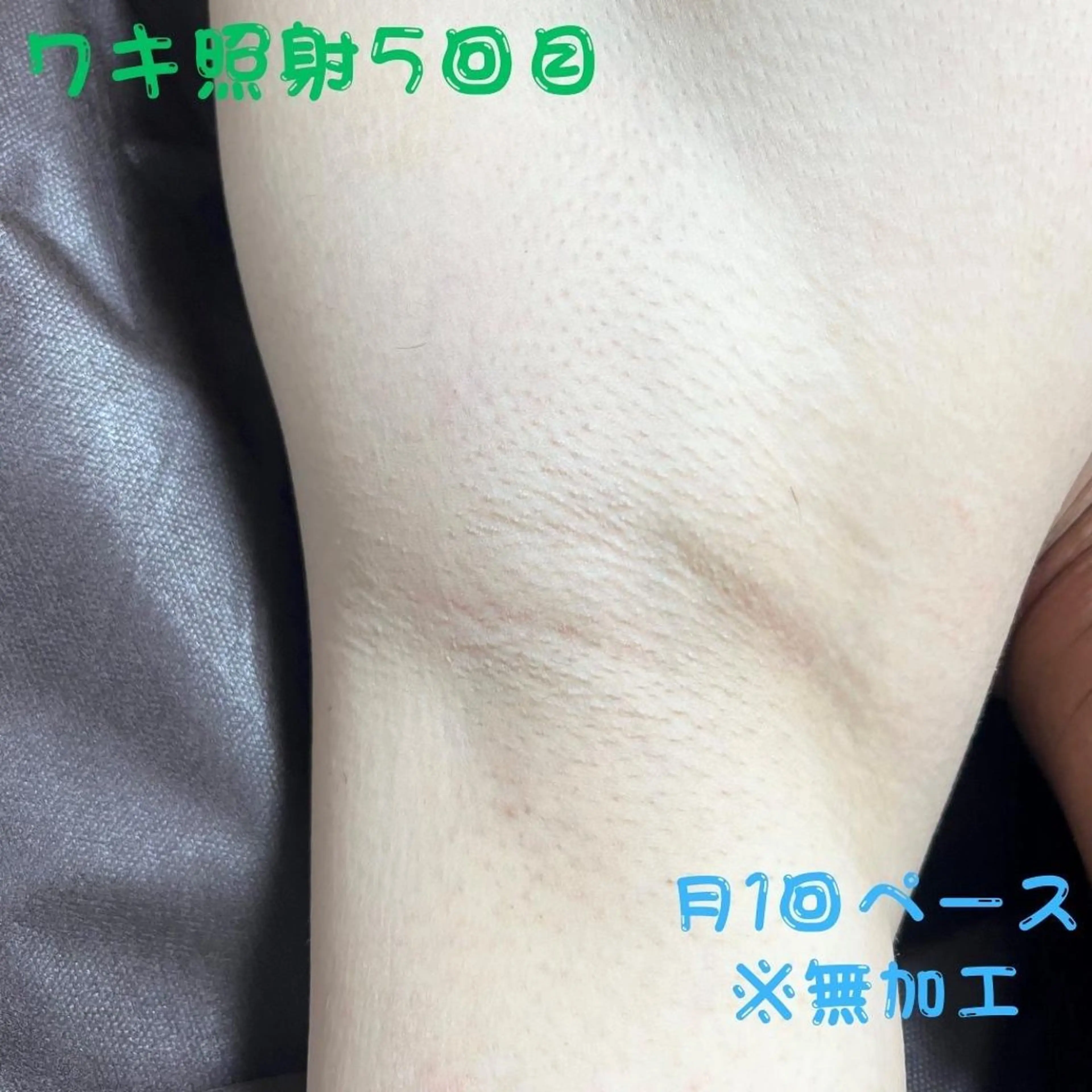 メンズ キッズ 脱毛 メンズ脱毛　FELISSE【フェリッセ】所属・メンズ脱毛フェリッセ /男女🆗キッズ🆗のエステ・リラクイメージ