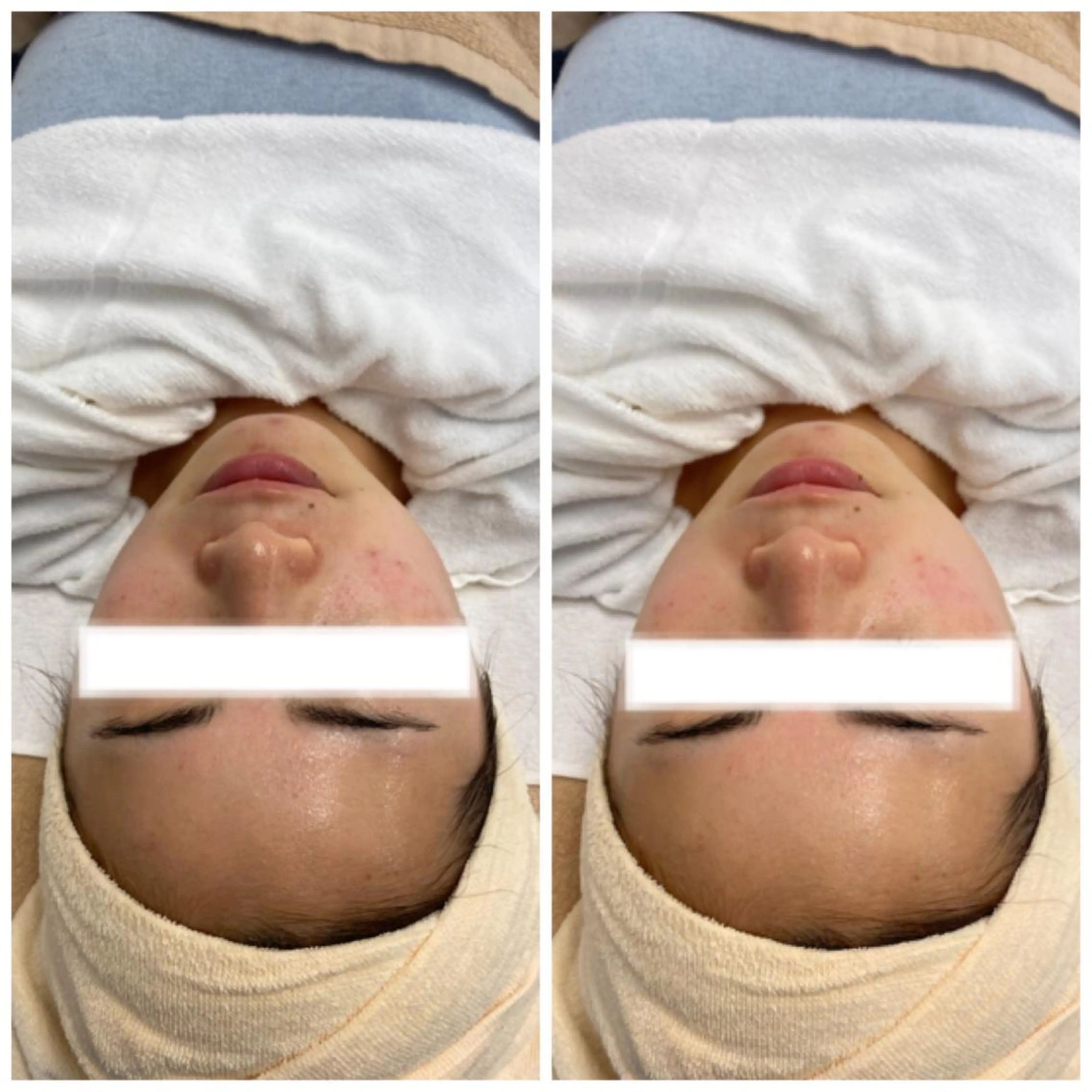 マツエク・マツパ アイブロウ 肌質改善美容サロン ému 用賀のエステ・リラクイメージ