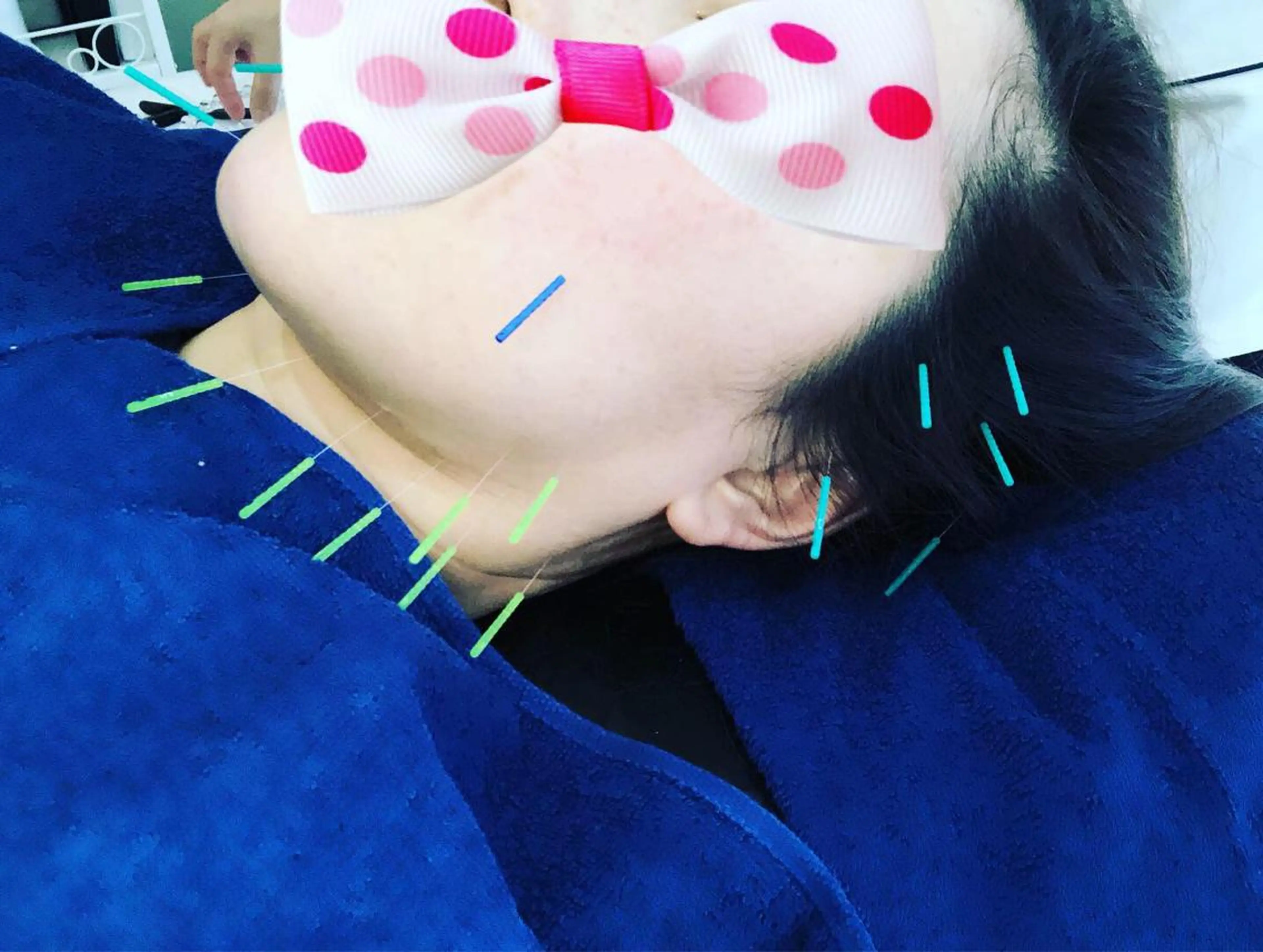 美容鍼灸女性専用 りんご鍼灸治療院のエステ・リラクイメージ