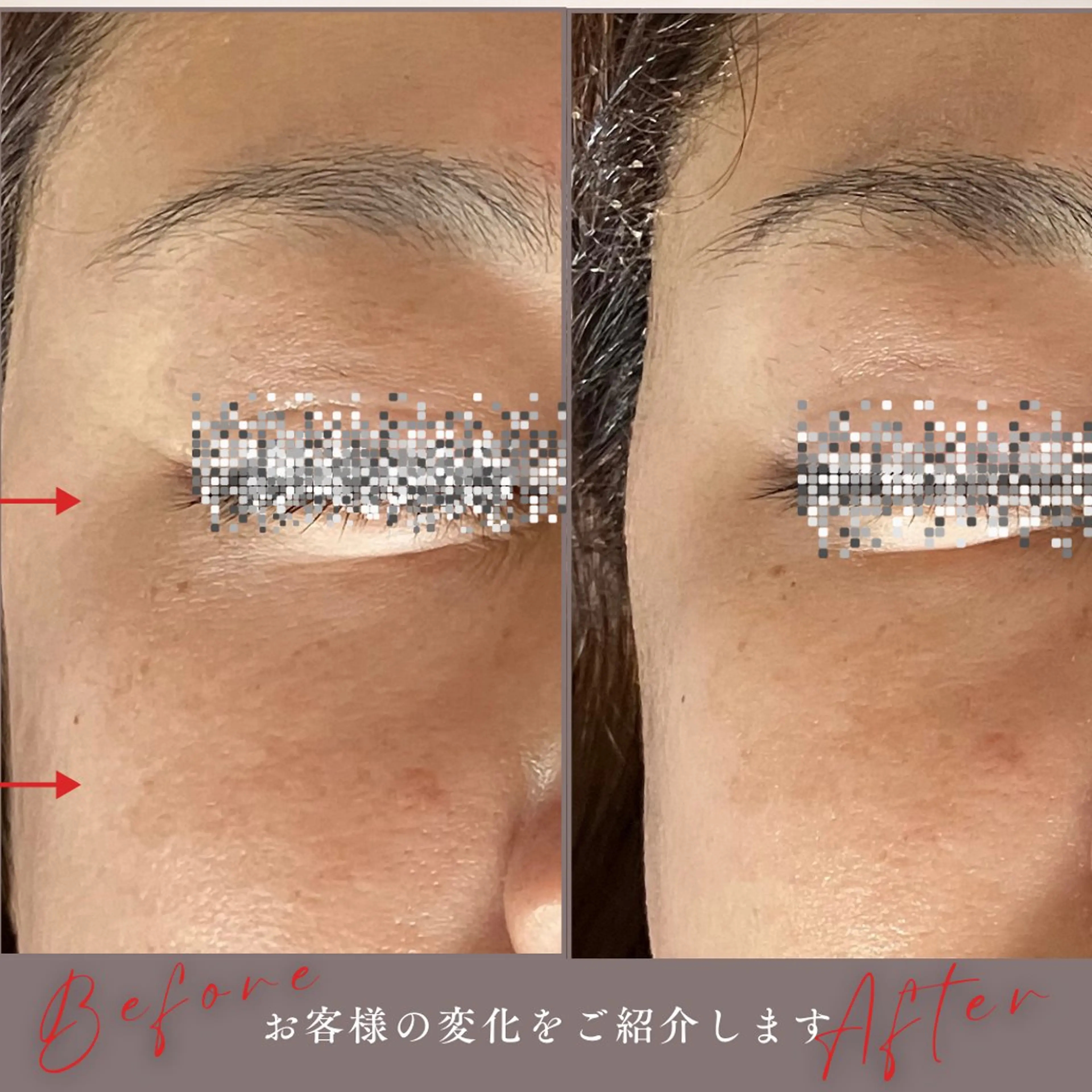 akua... 【肌質管理専門】のその他イメージ