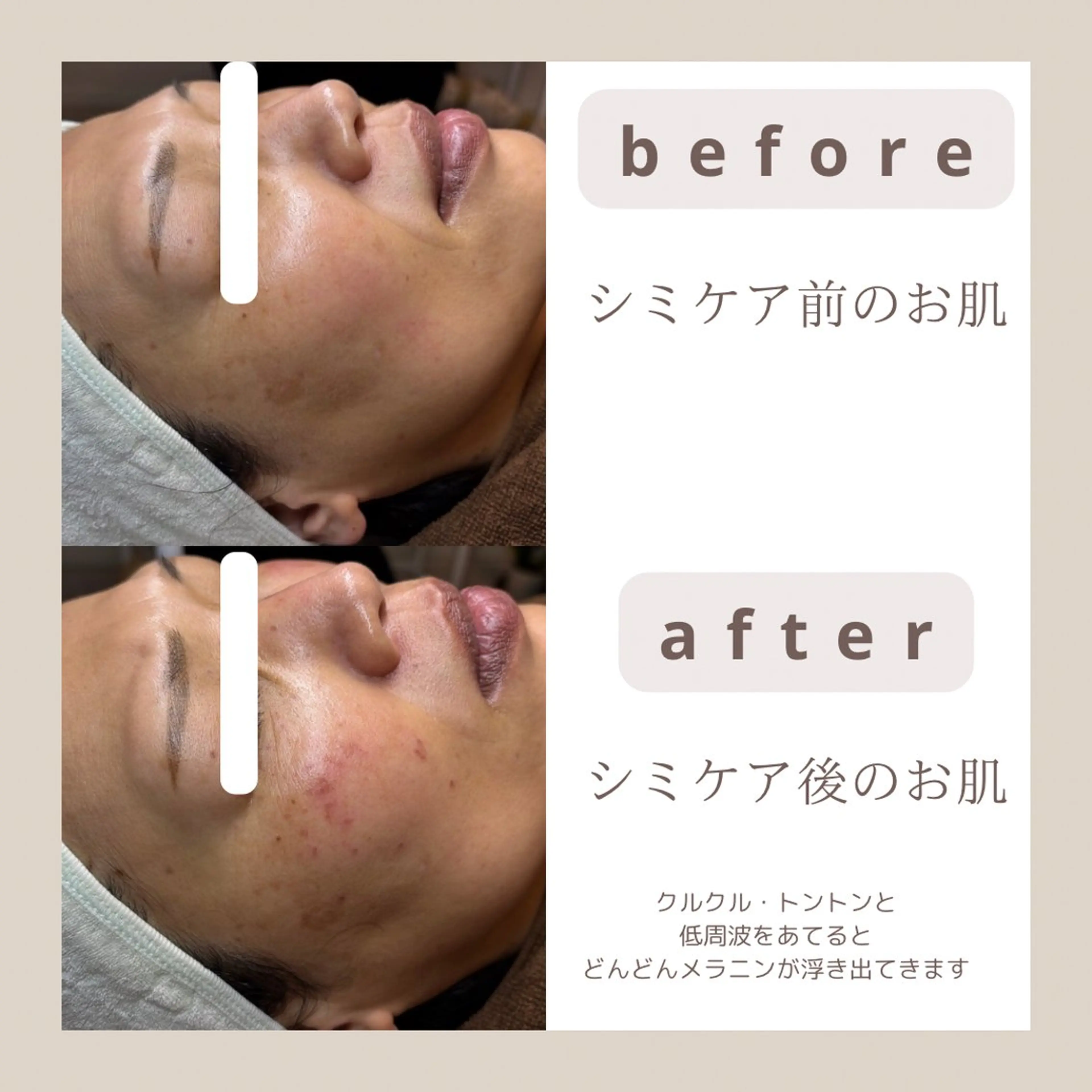 エステ emiluka beautyのエステ・リラクイメージ