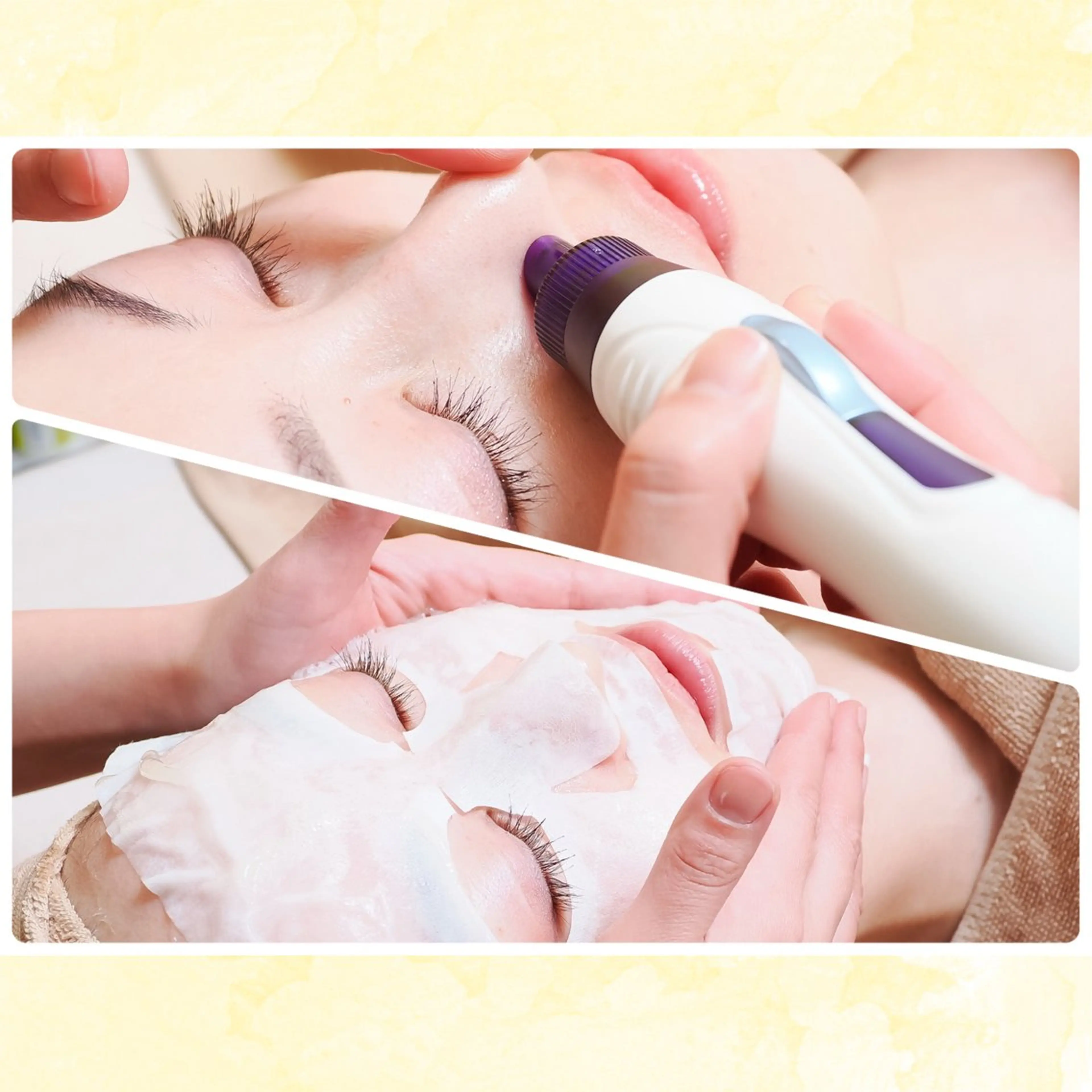 【毛穴悩みに✨】カーボキシー炭酸パック＋ハイドラ毛穴洗浄＋美容液導入の写真