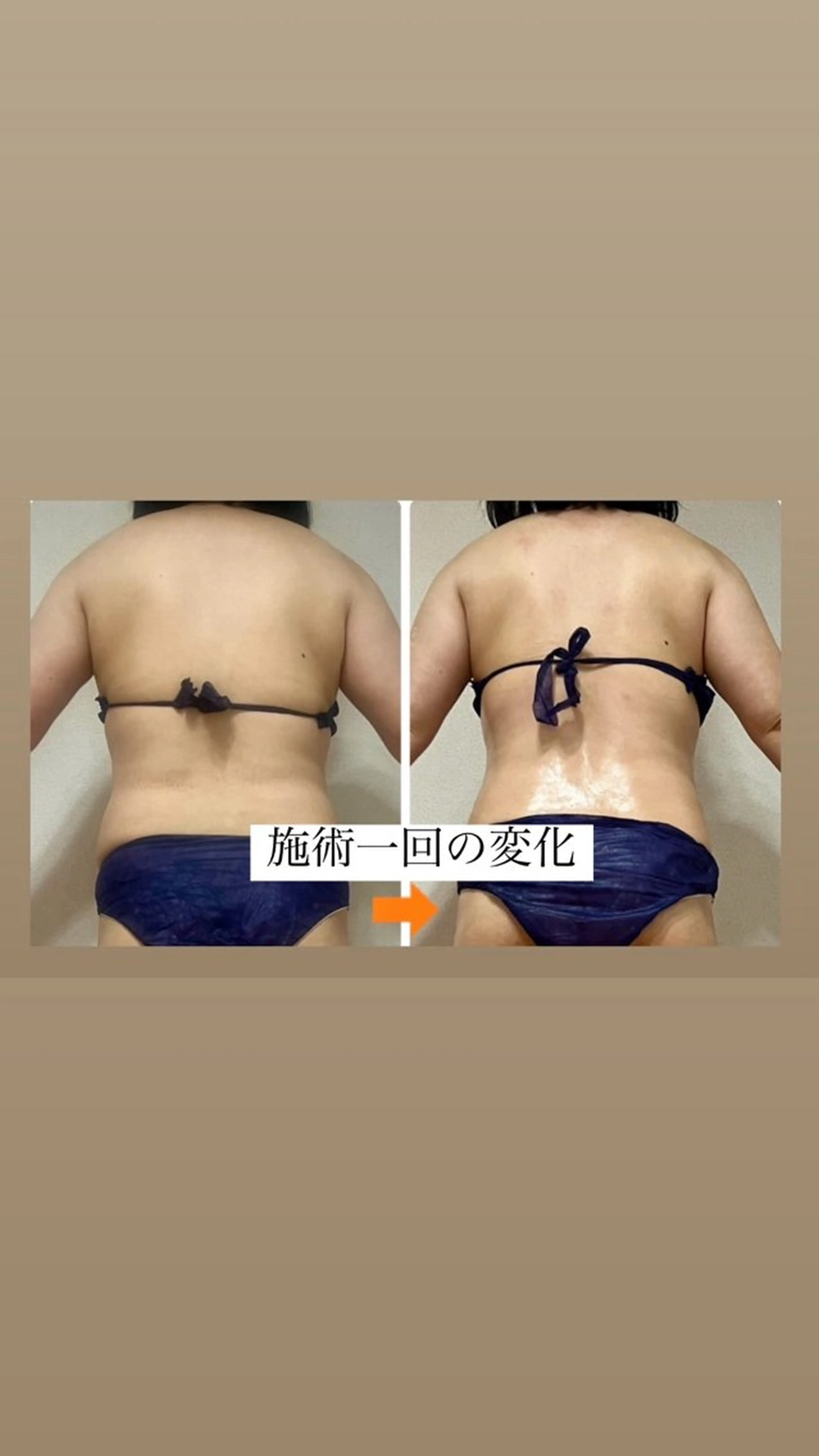 ショート エステ リラク ‍痩身＆ボディ 結果出し🌟丹野のエステ・リラクイメージ