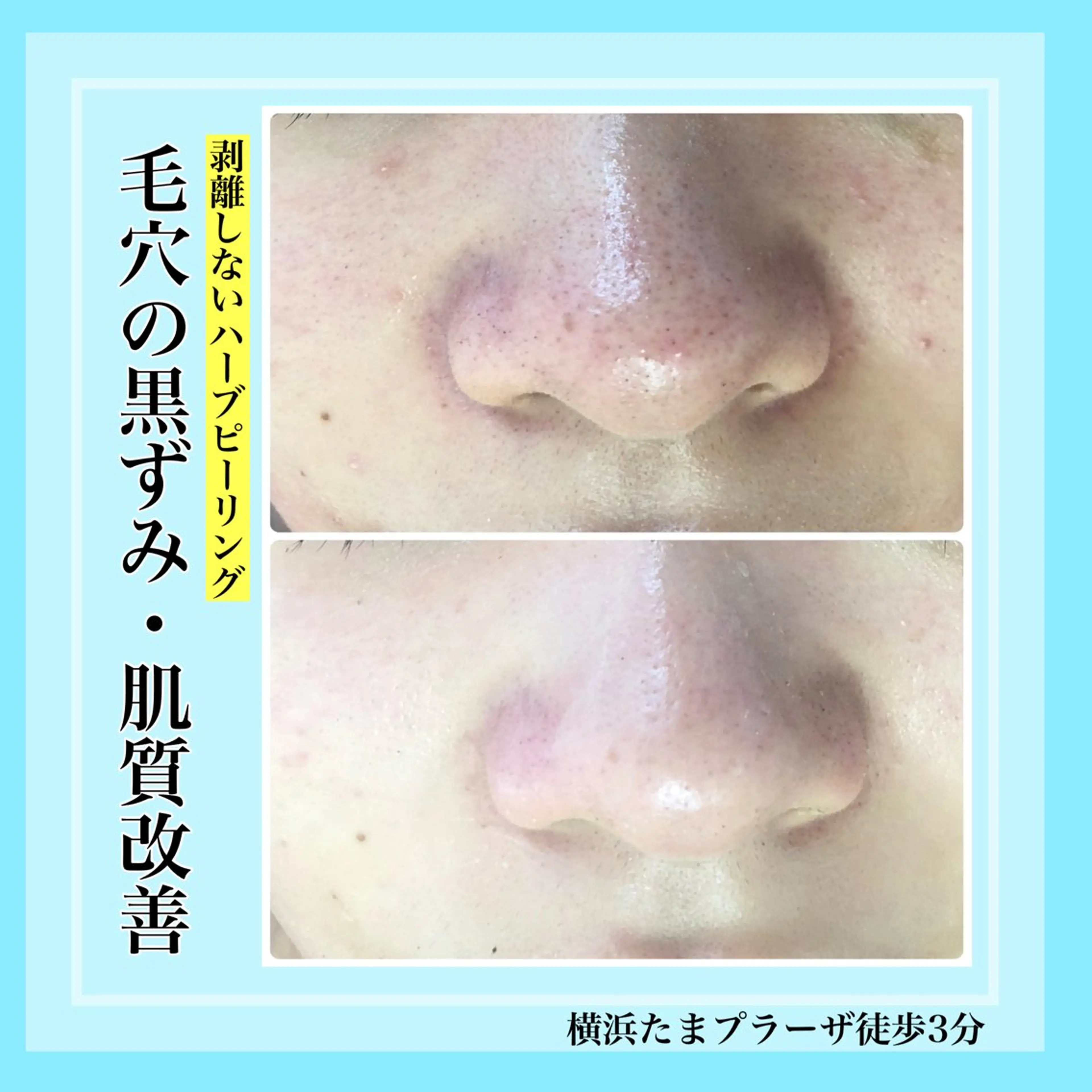 エステ LILIANA所属・LILIANA ☆YURIのエステ・リラクイメージ