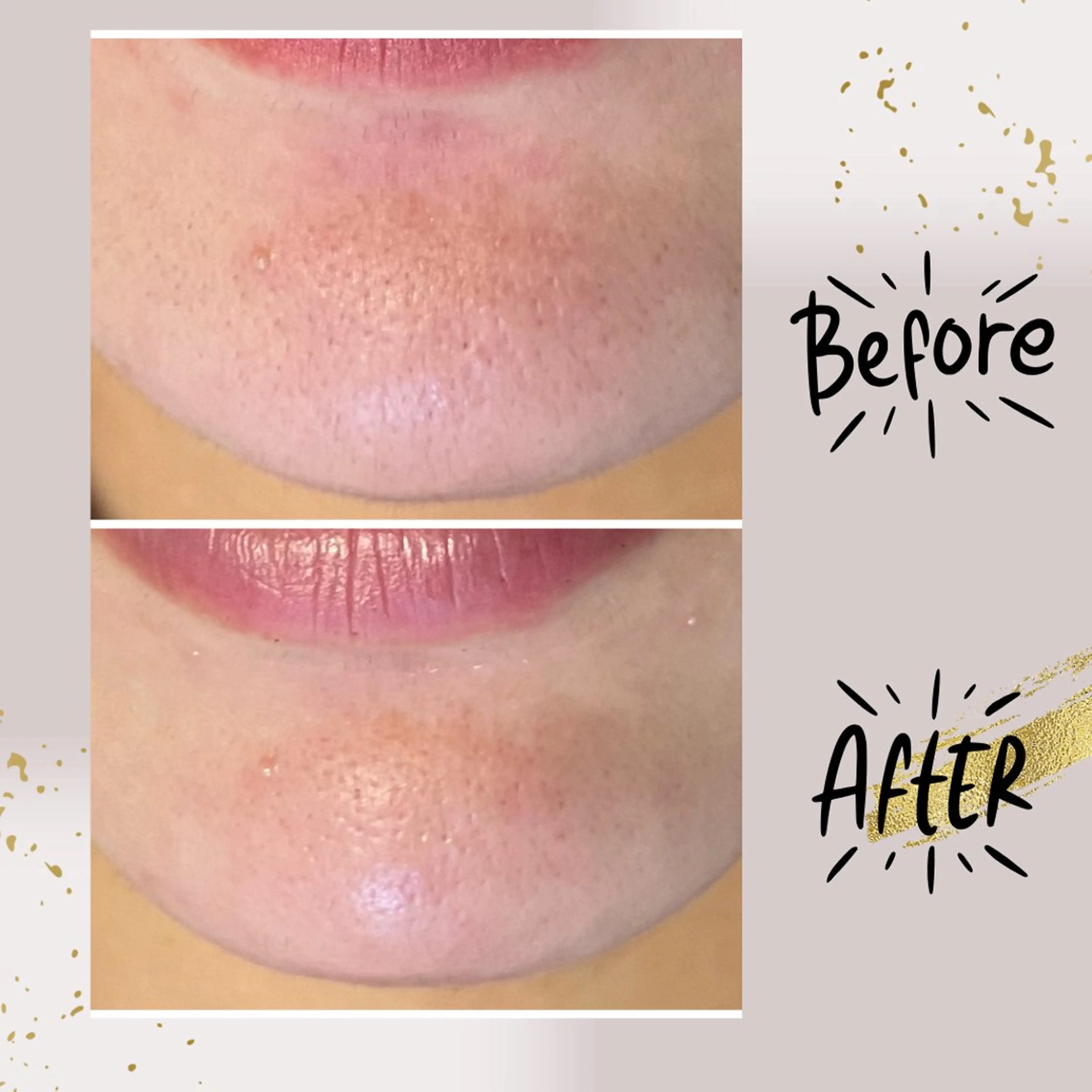 エステ リラク ピーリング専門店 Belluteのエステ・リラクイメージ