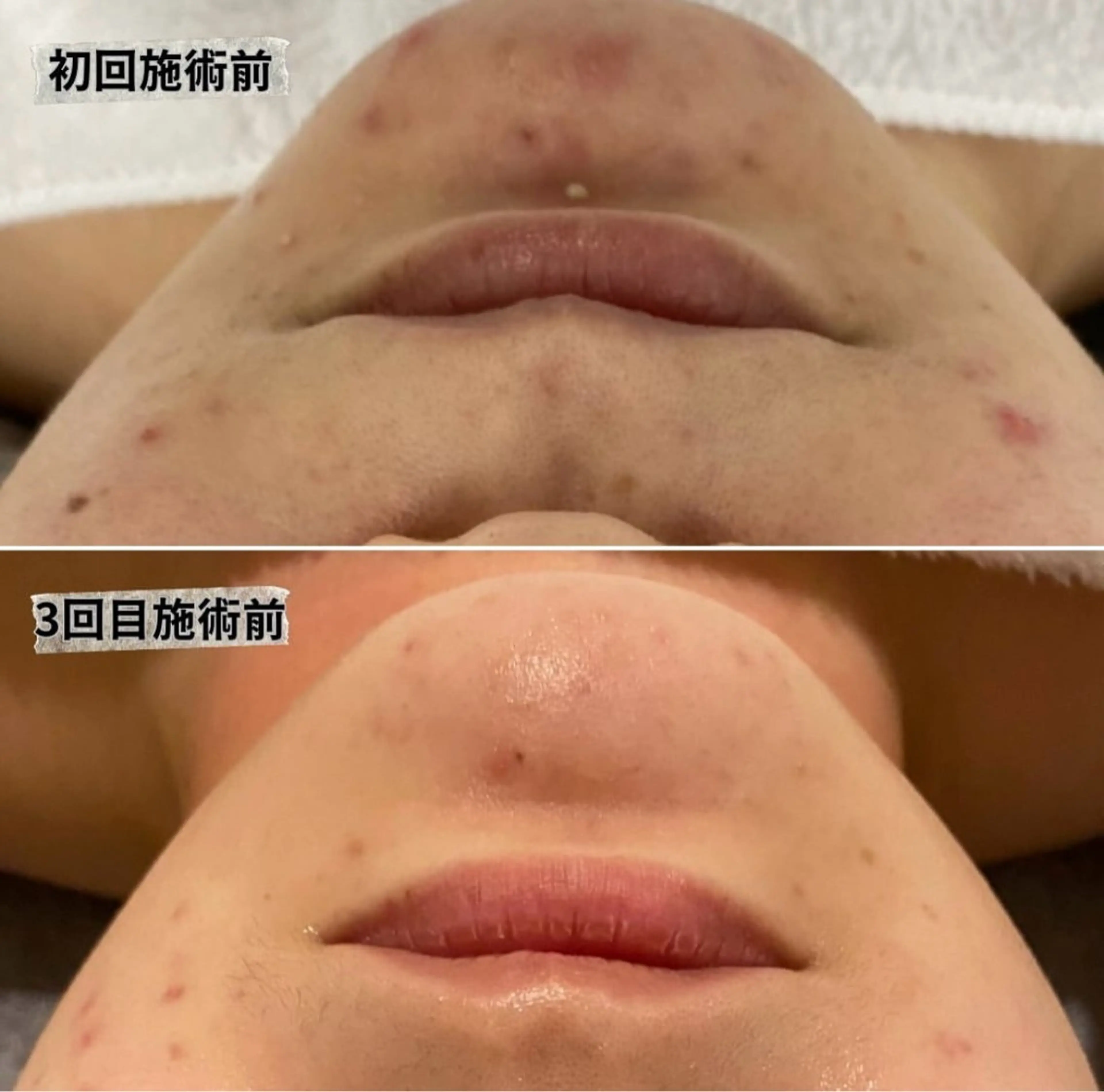 エステ Re Amply Minamiのエステ・リラクイメージ