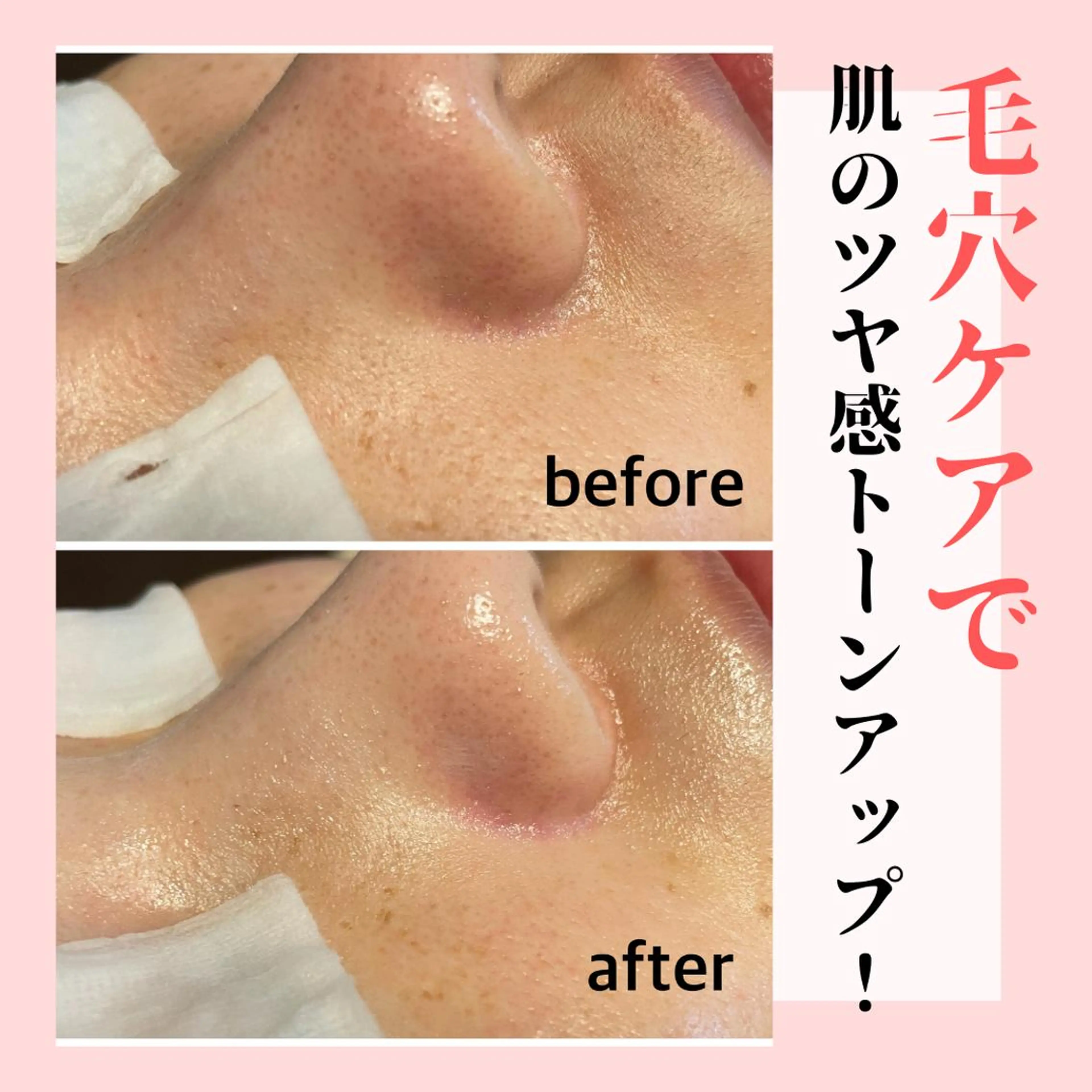 ピーリング専門店 Belluteのエステ・リラクイメージ