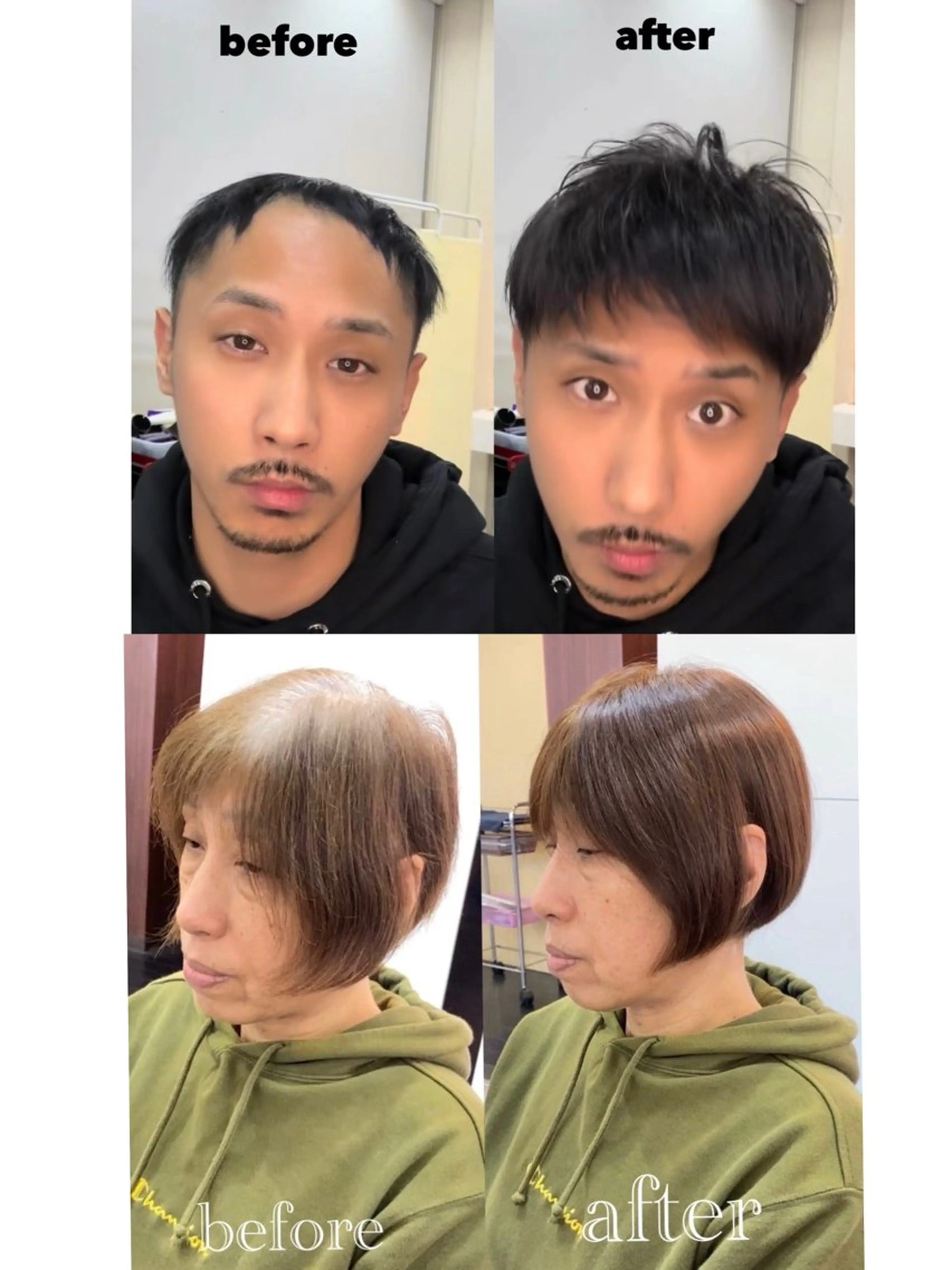 ウィッグカウンセリング無料の写真