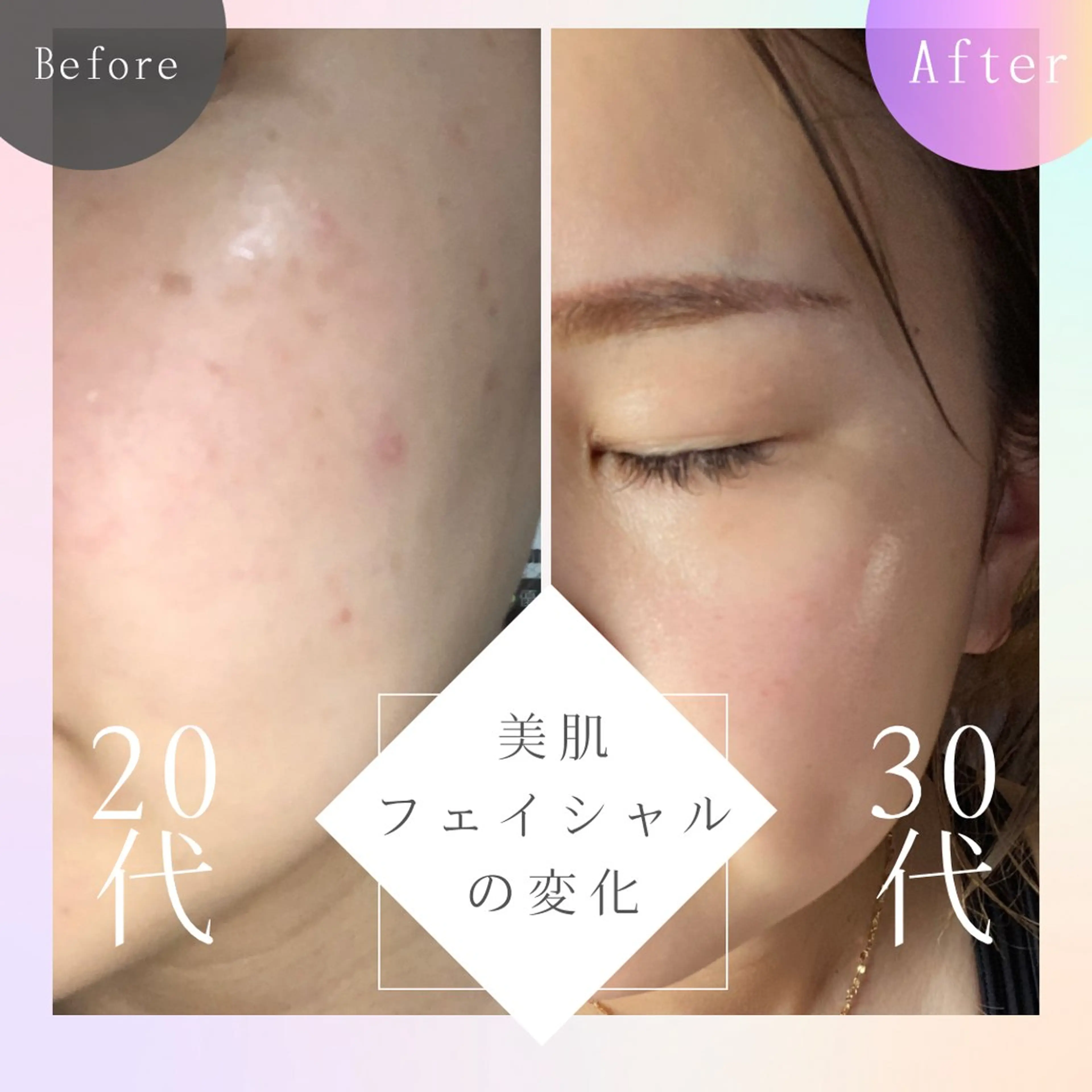 美肌脱毛と癒しのﾌﾟﾗｲﾍﾞｰﾄｻﾛﾝ。gratia~ｸﾞﾚｲﾃｨｱ~所属・gratia ~ｸﾞﾚｲﾃｨｱ~のエステ・リラクイメージ