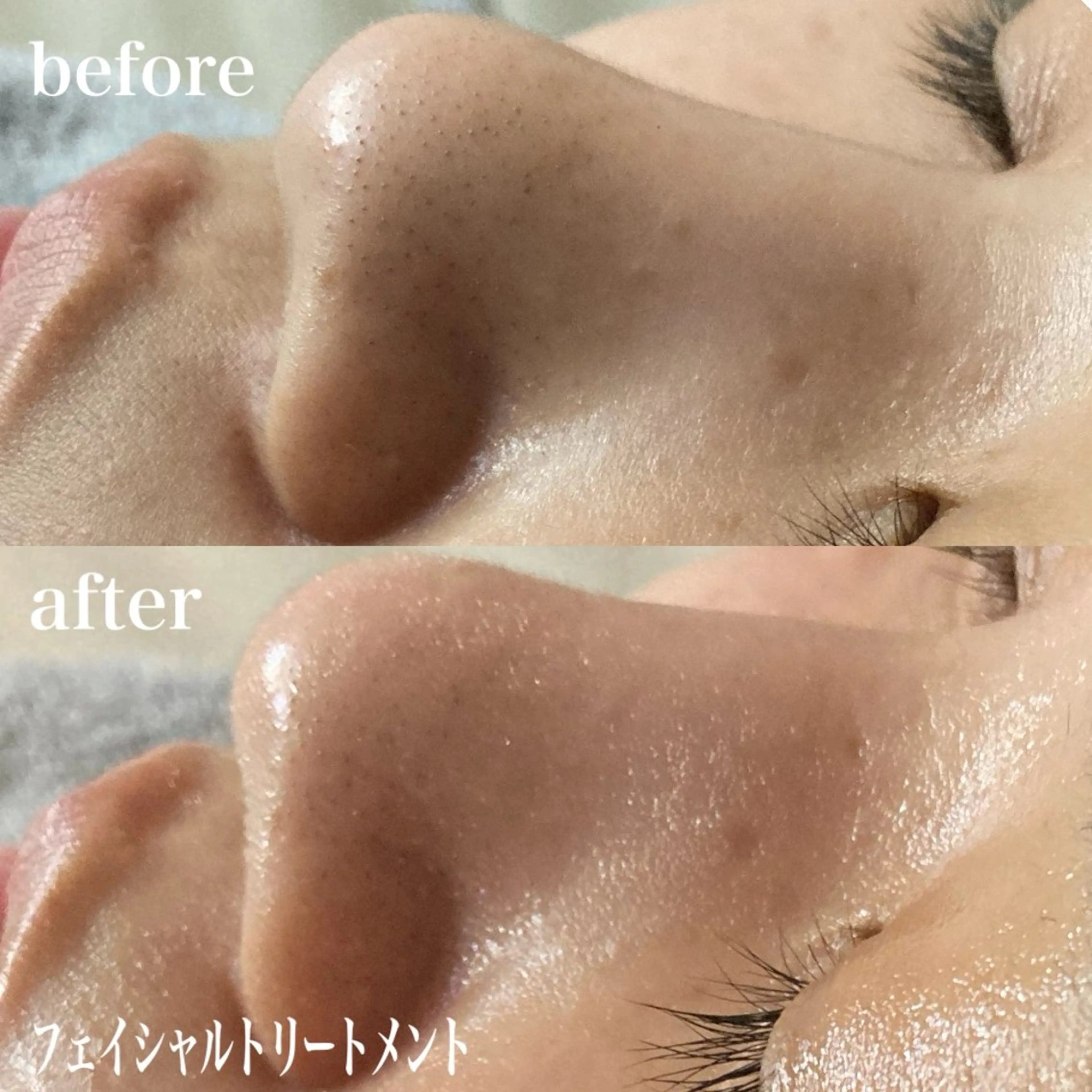 磐田｜LAYLA 一番丁寧な脱毛店のエステ・リラクイメージ