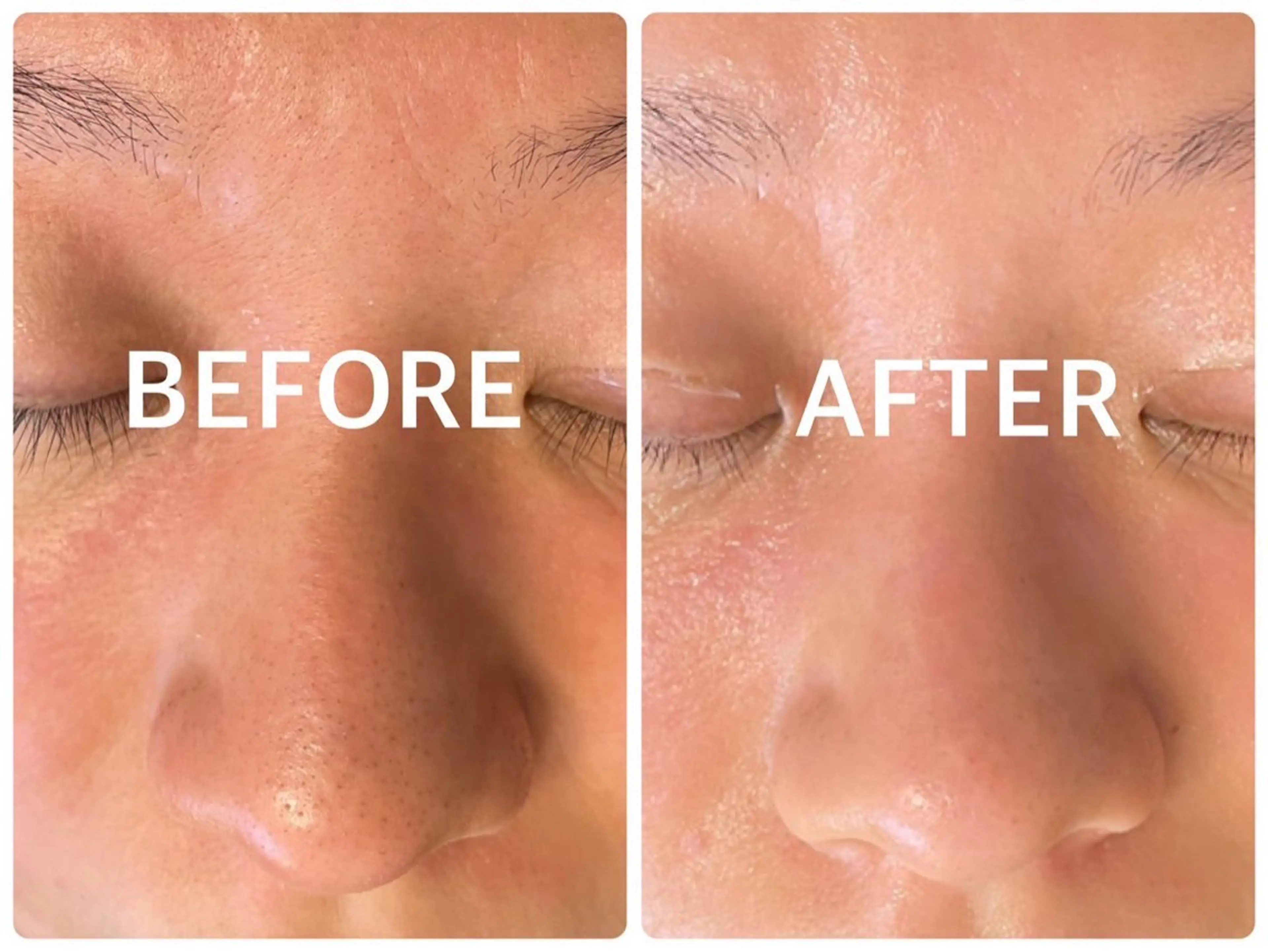 ハーブピーリング 横浜のエステ・リラクイメージ