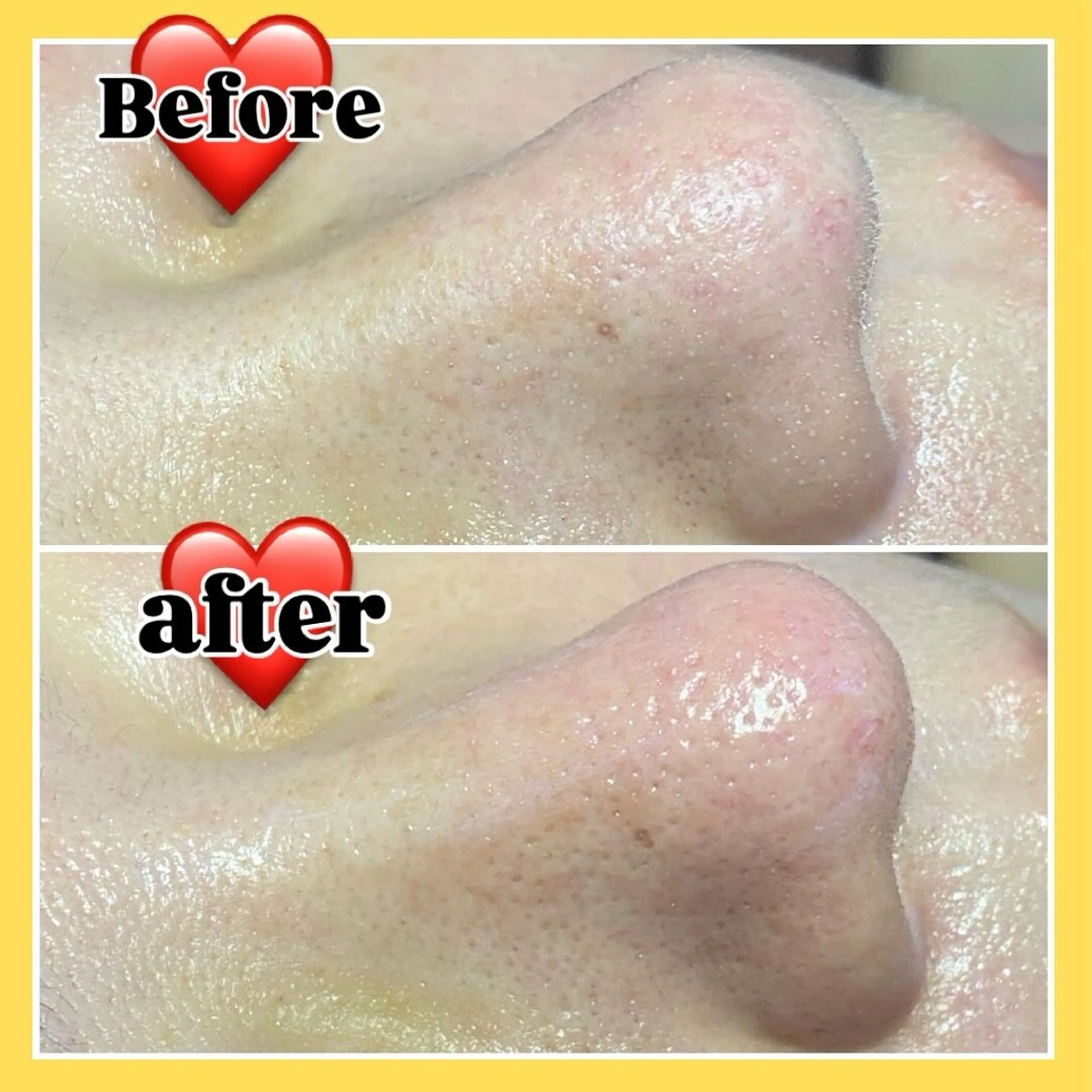 毛穴フェイシャル エステ専門店BBのエステ・リラクイメージ