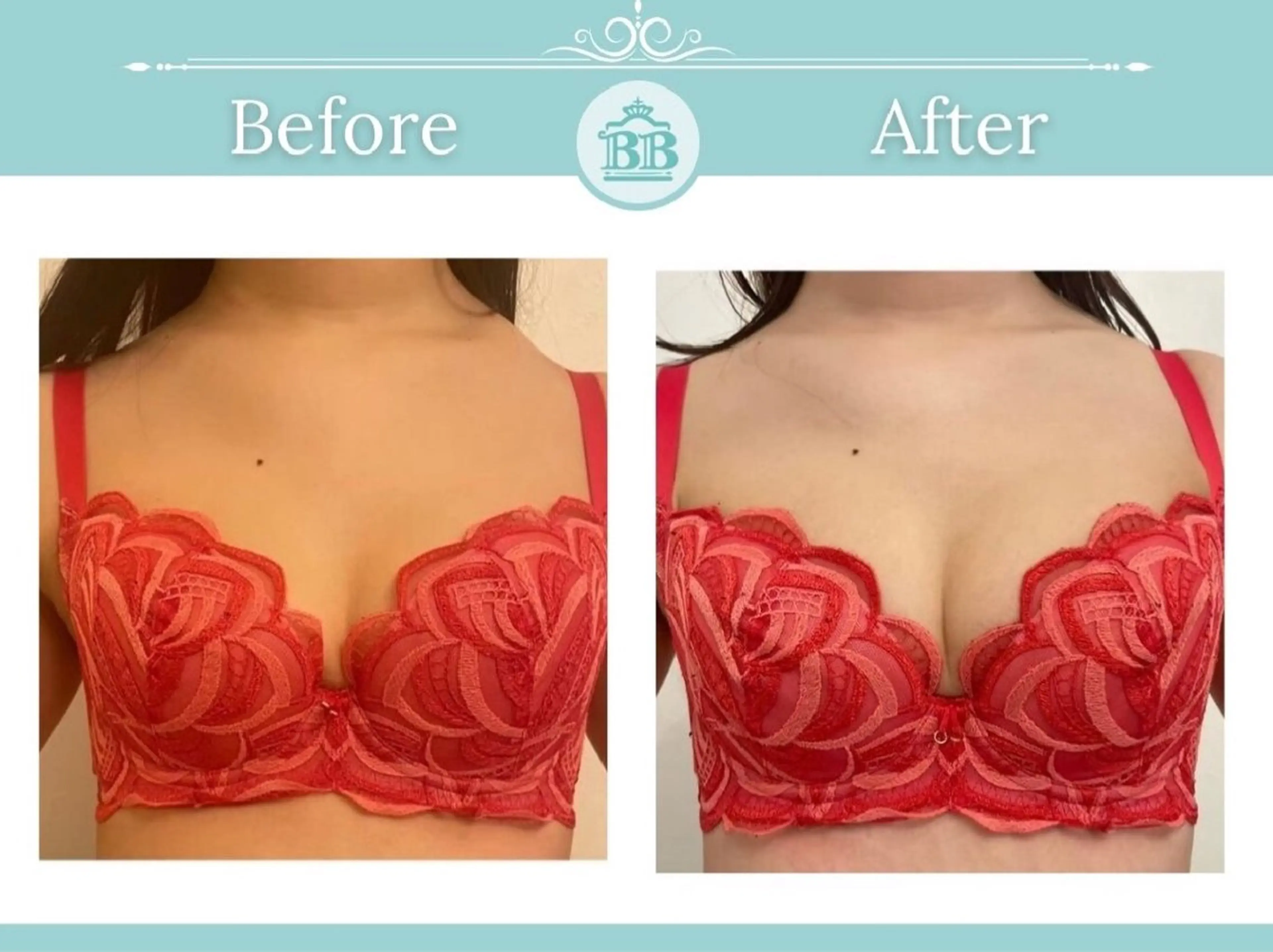 エステ 美人バスト本厚木店所属・美人バスト 本厚木店のエステ・リラクイメージ