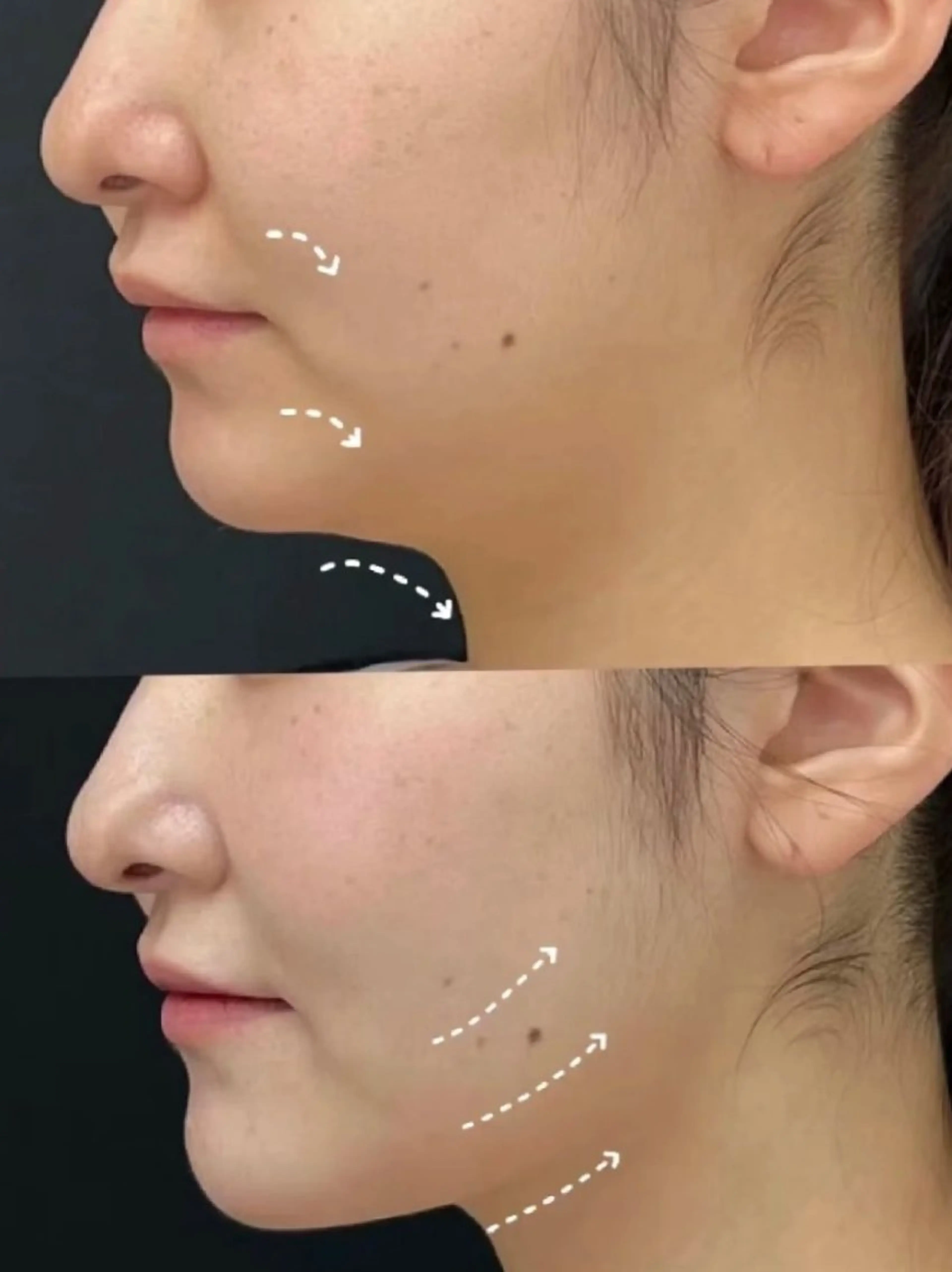 その他 aliaハイフ&水光ジェットサロン所属・aliaハーブ水光店 エステティシャン募集のエステ・リラクイメージ