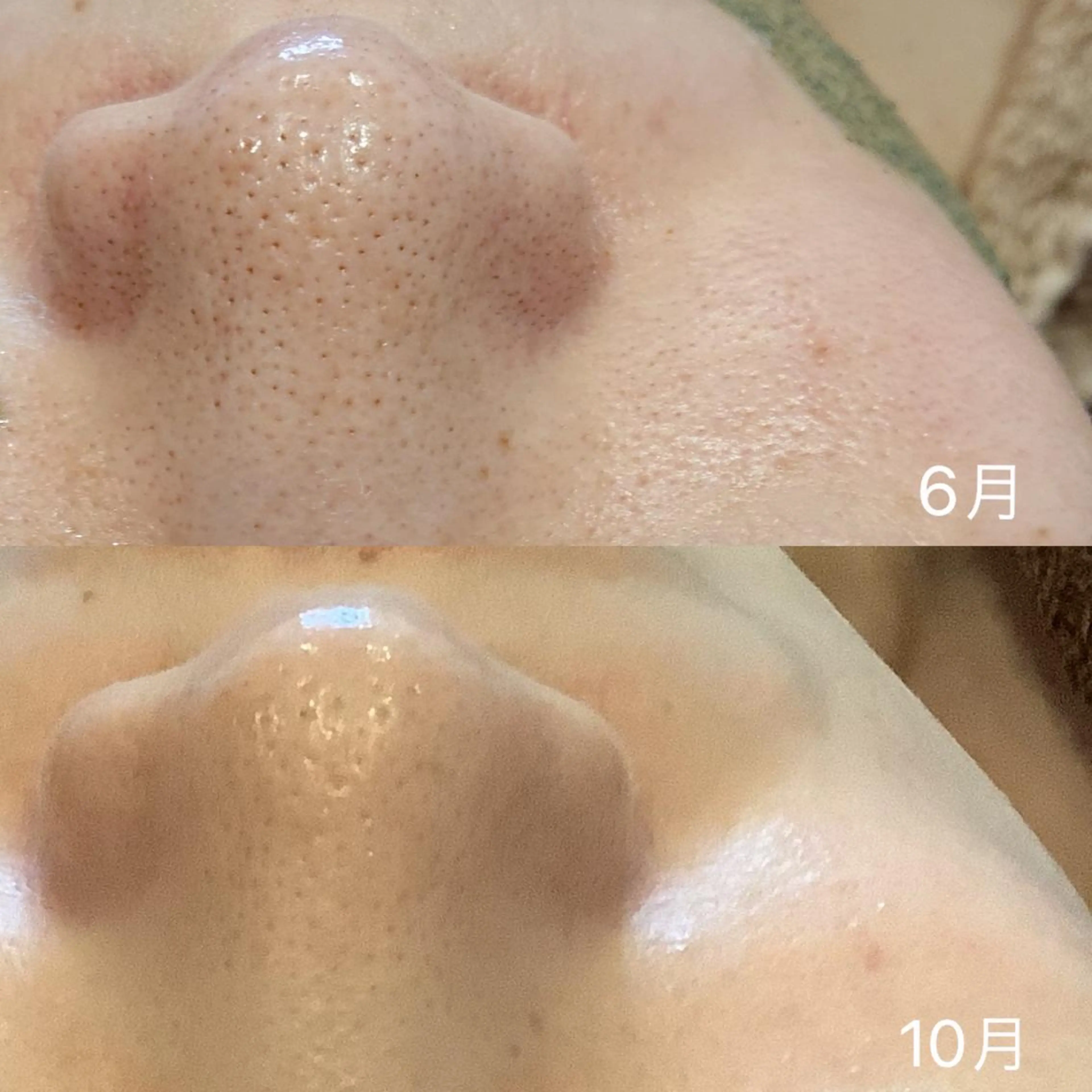 Beauty   Salon  Adiy所属・Adiy ikumiのエステ・リラクイメージ