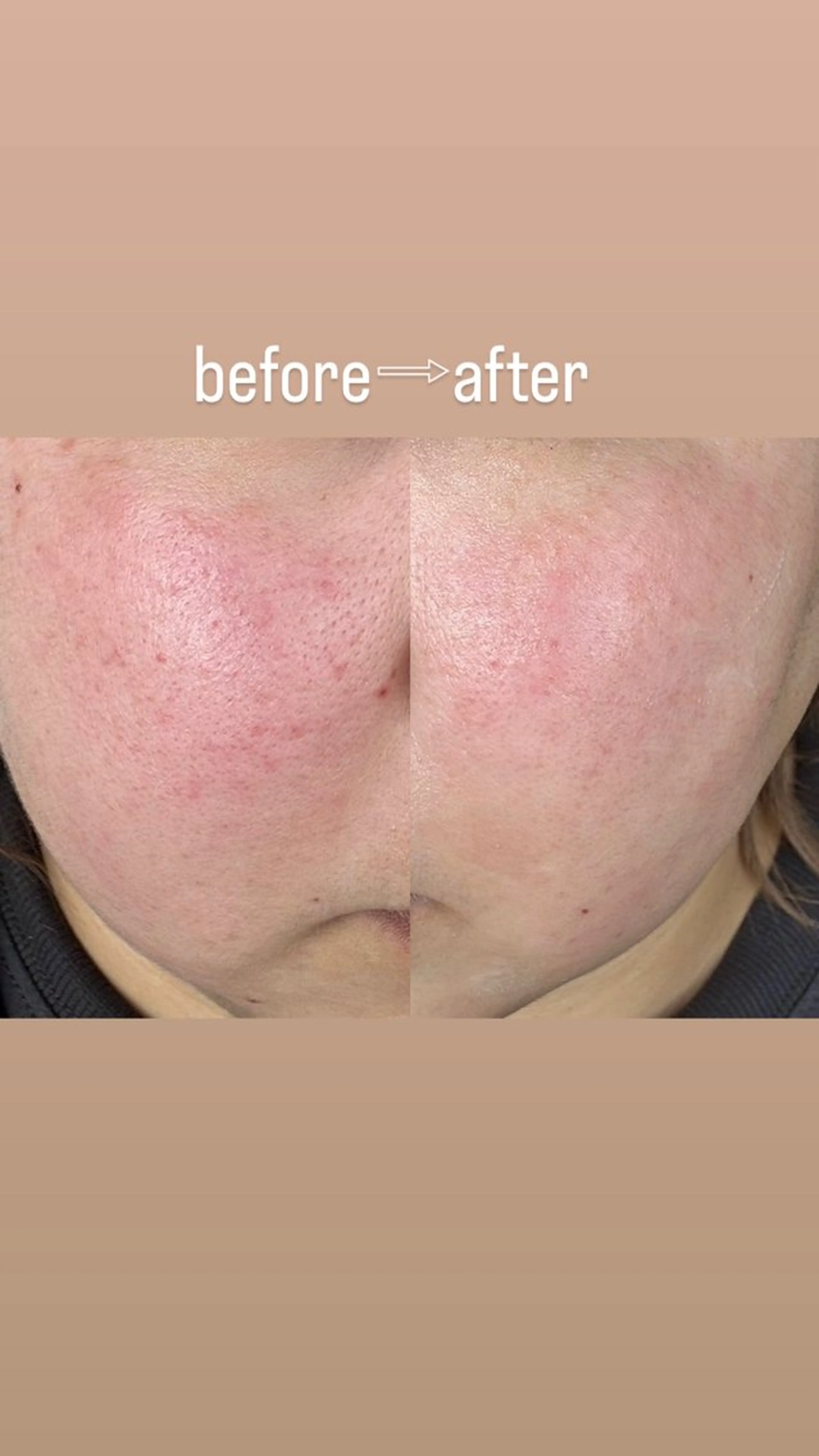 Sena Dewi所属・Sena Dewi SAE🌼のエステ・リラクイメージ