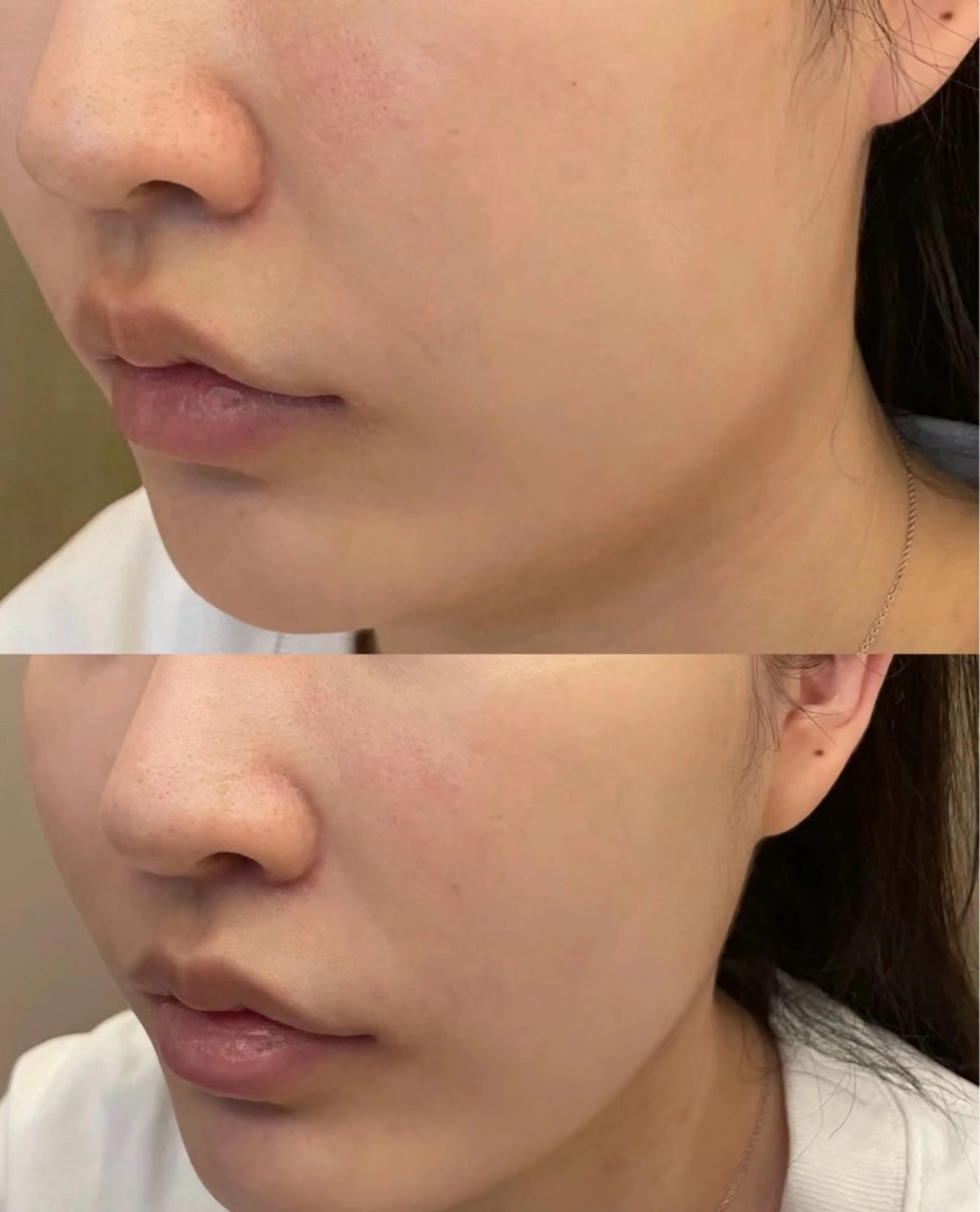 マツエク・マツパ エステ aliaハイフ&水光ジェットサロン所属・aliaハーブ水光店 エステティシャン募集のエステ・リラクイメージ