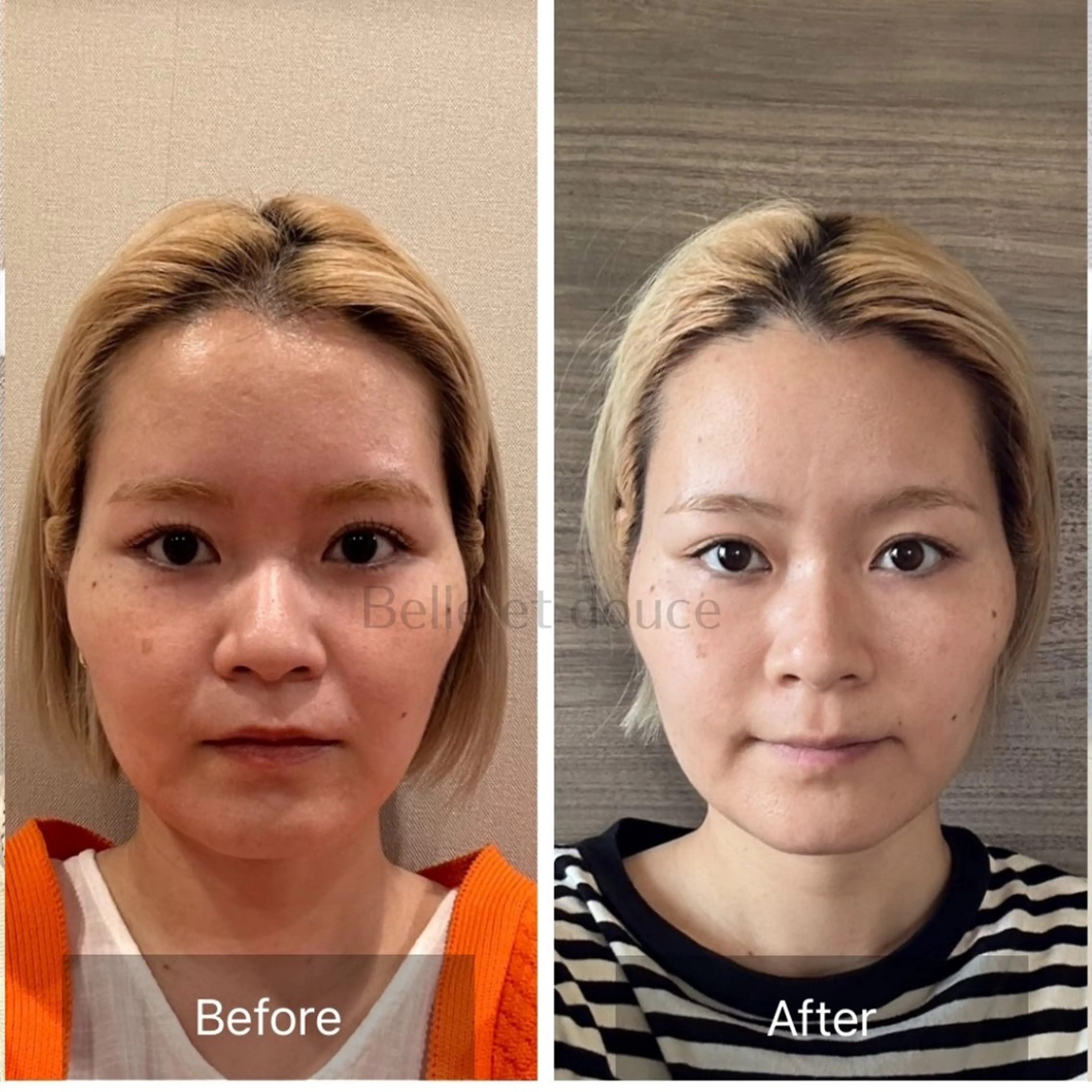 エステ Belle et douce所属・毛穴ケア専門サロン ベルエドゥースのエステ・リラクイメージ