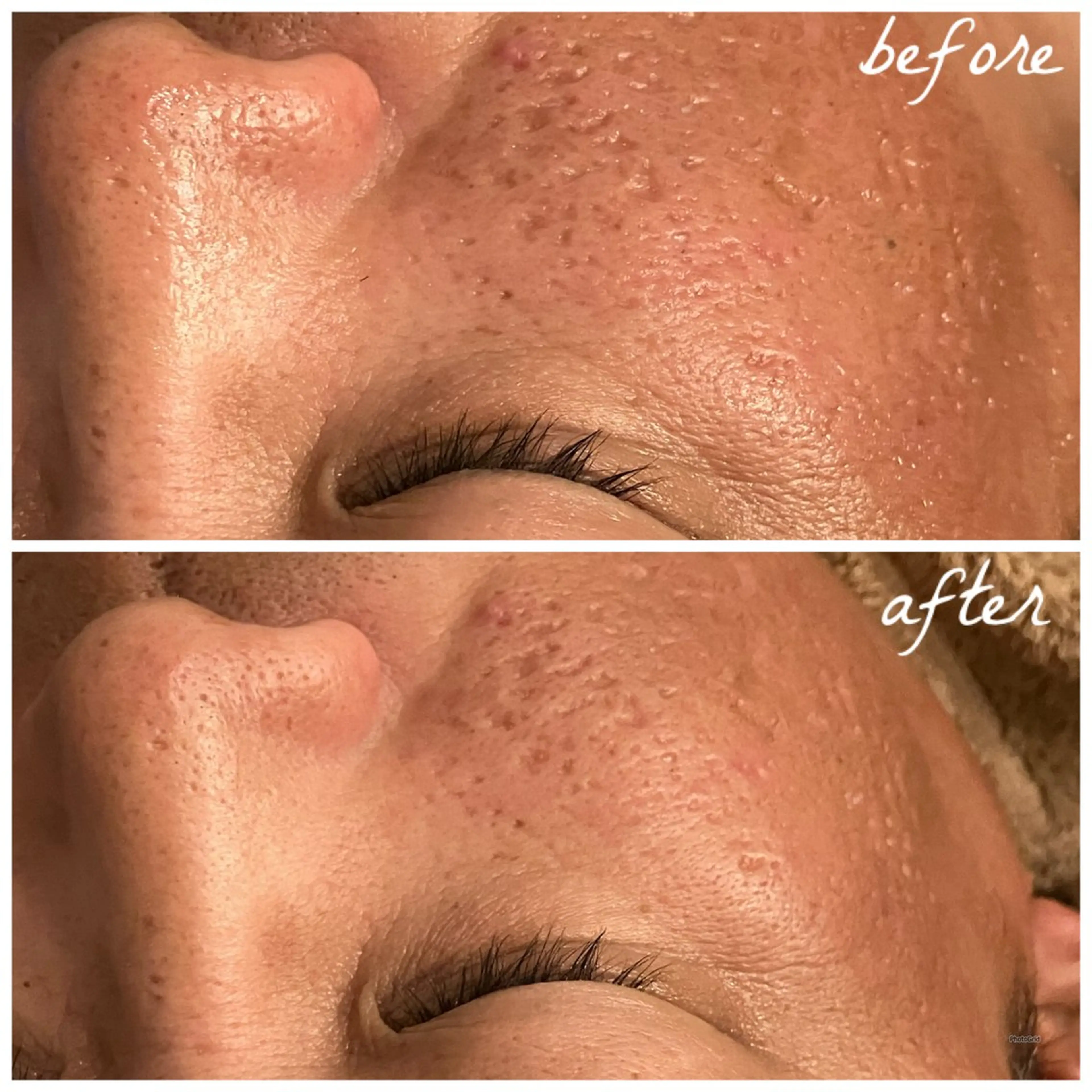 メンズ メナード岐阜茜部 杉浦のエステ・リラクイメージ