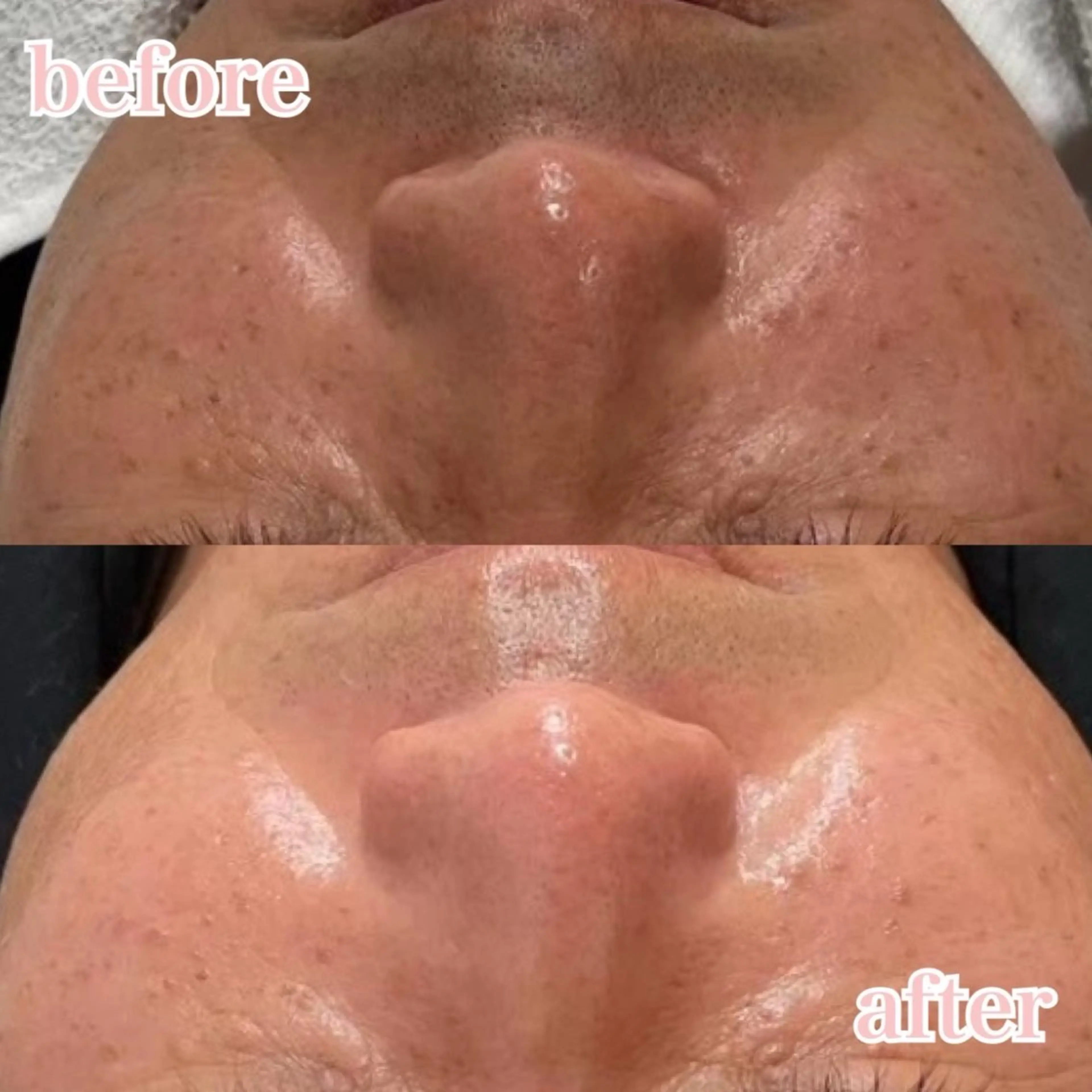 肌管理専門店Whitelabo堺東店所属・おだ あみのエステ・リラクイメージ