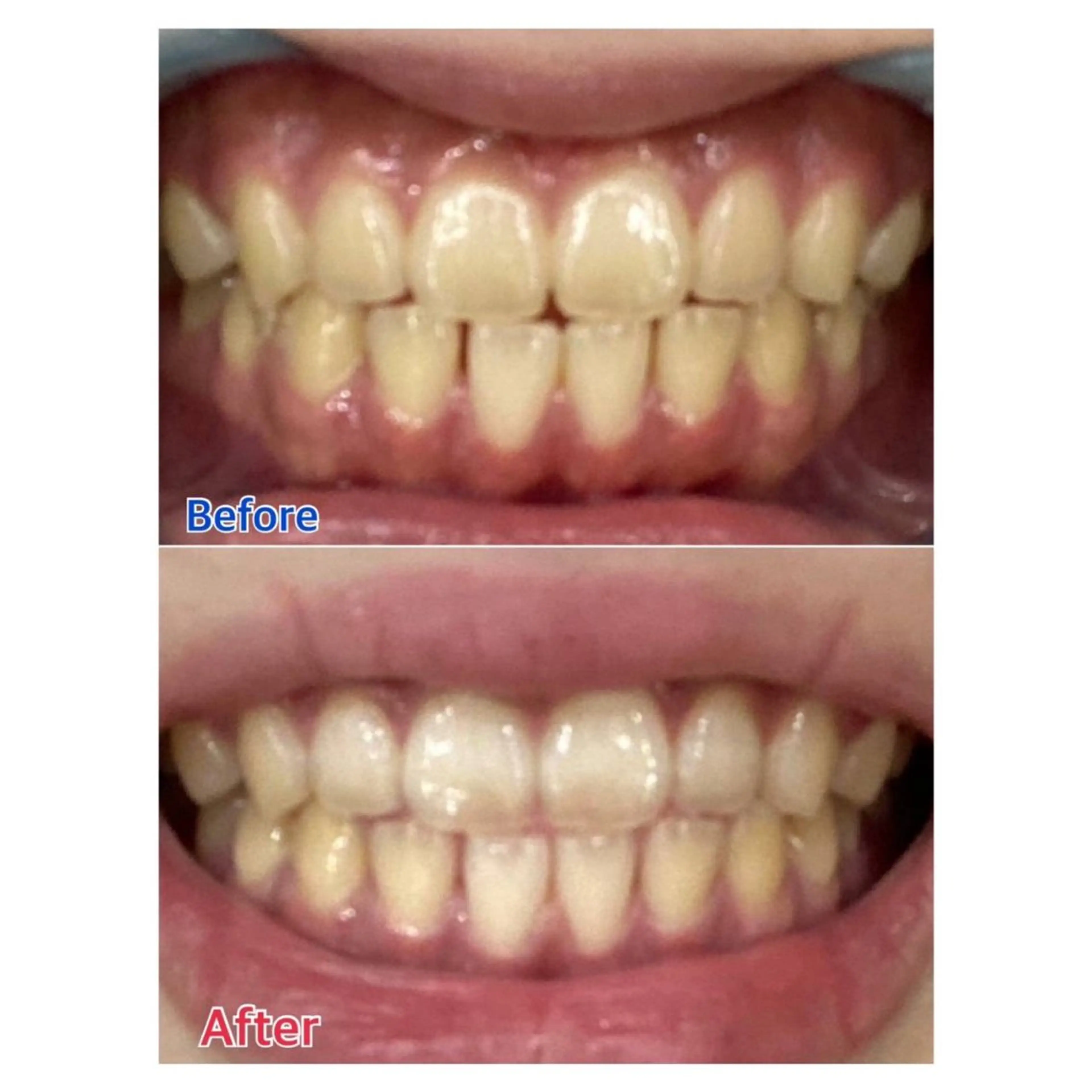 MBEAUTYSALON 千葉店・京成大久保所属・Melty 輝のその他イメージ