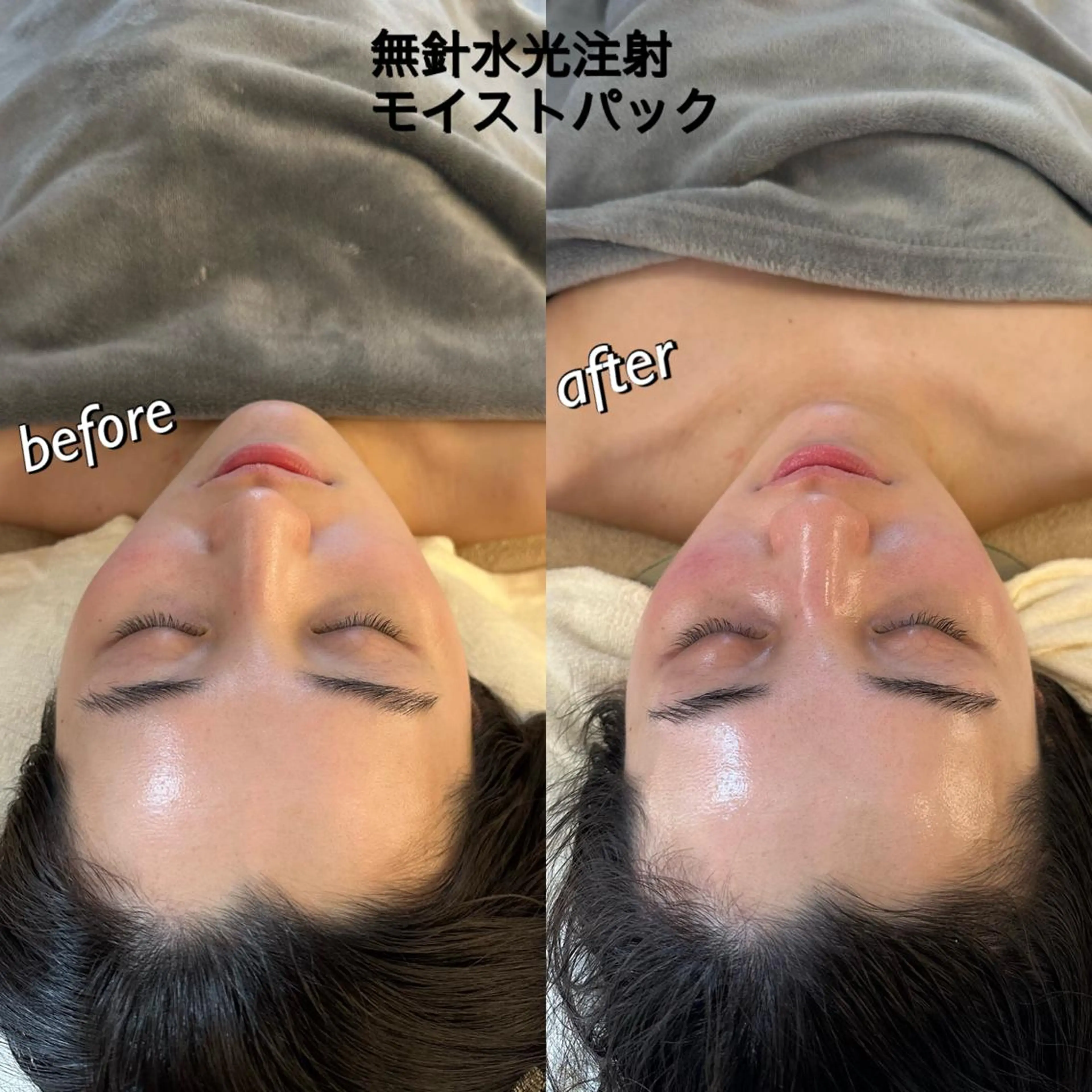 うなじ脱毛/美肌脱毛 LABELのエステ・リラクイメージ