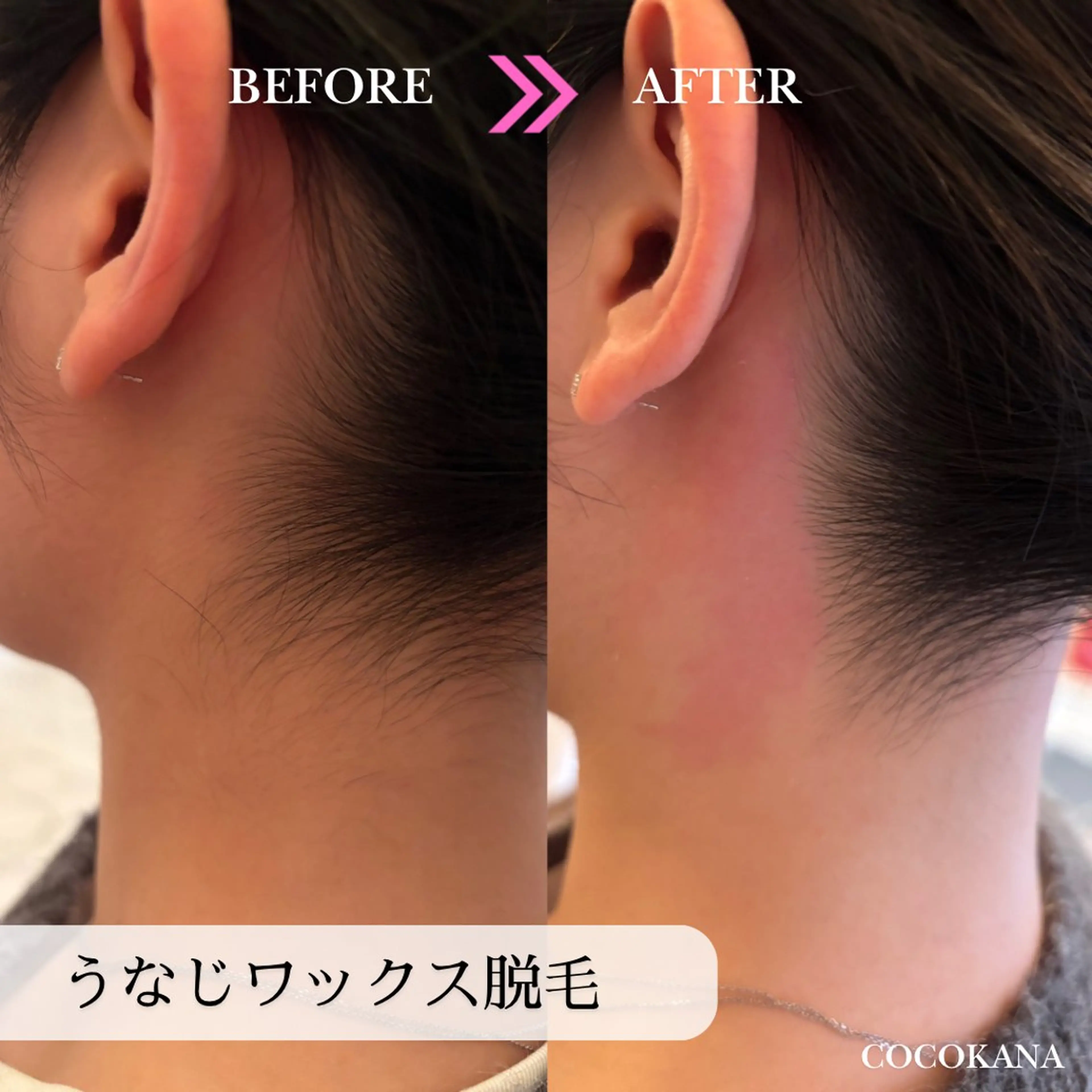 脱毛サロン COCOKANA所属・脱毛サロン COCOKANAの眉毛・アイブロウイメージ