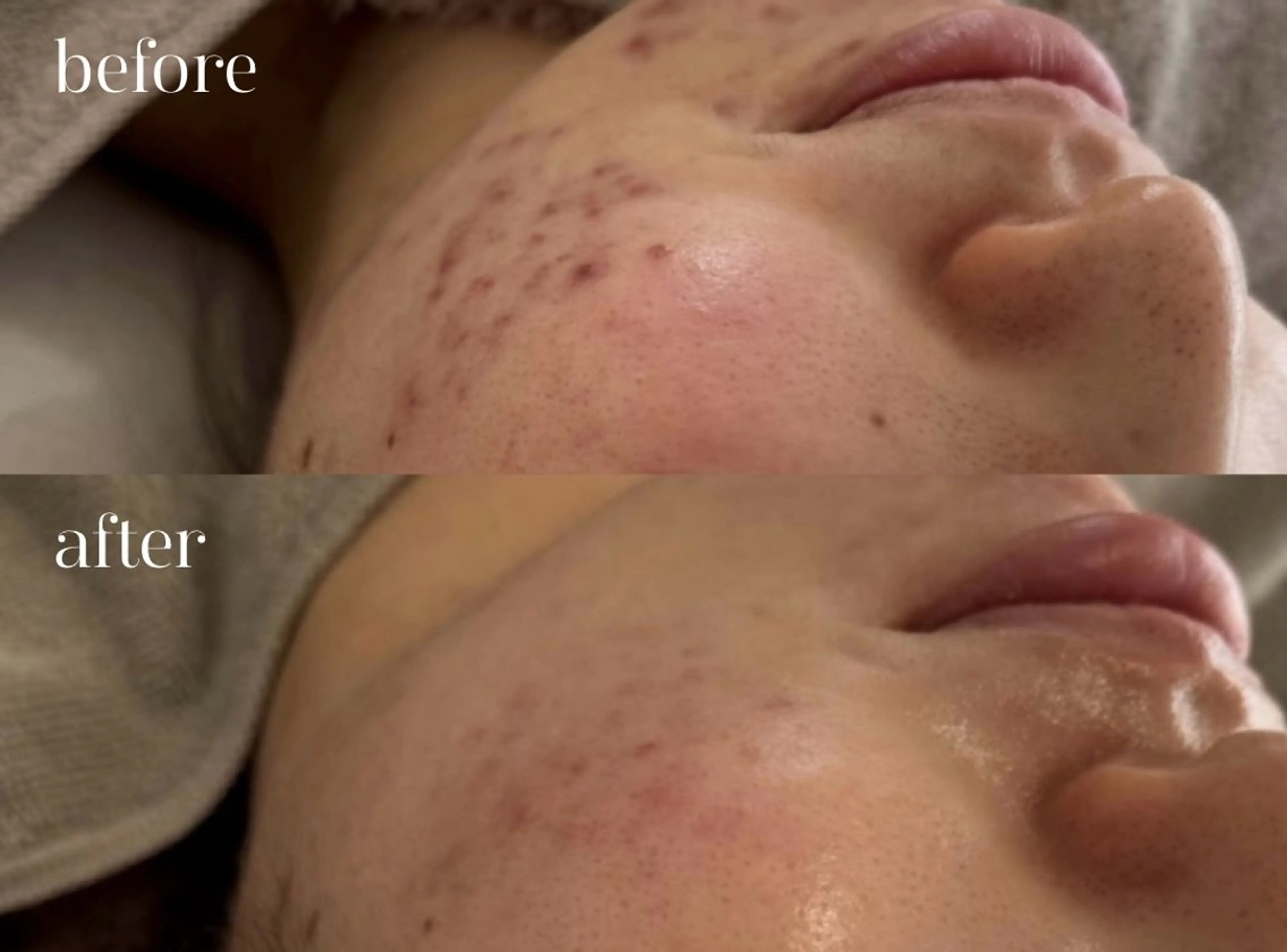 肌質改善・毛穴サロン Chéfiaのエステ・リラクイメージ