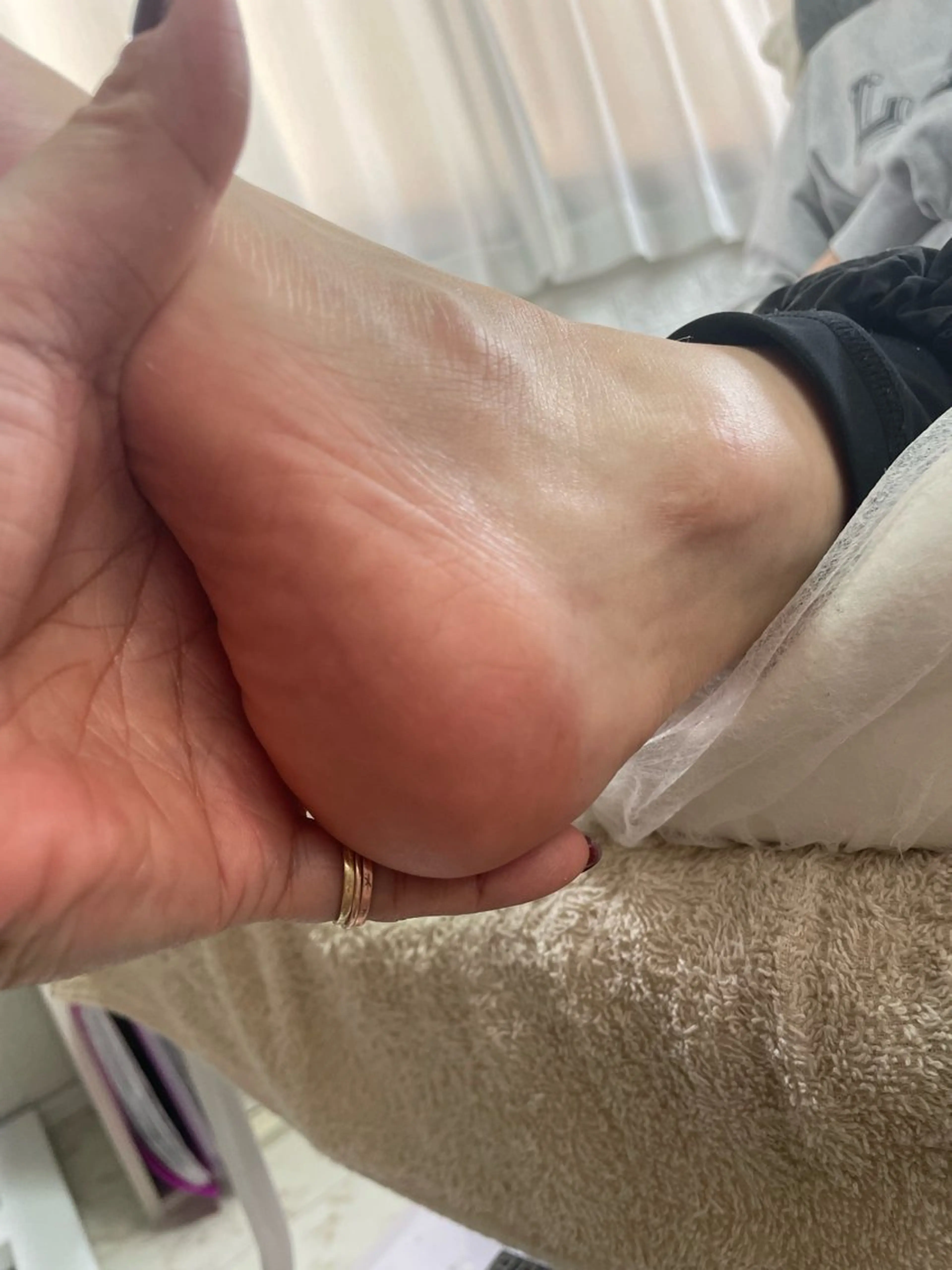 その他 Estotibi エストティビのその他イメージ