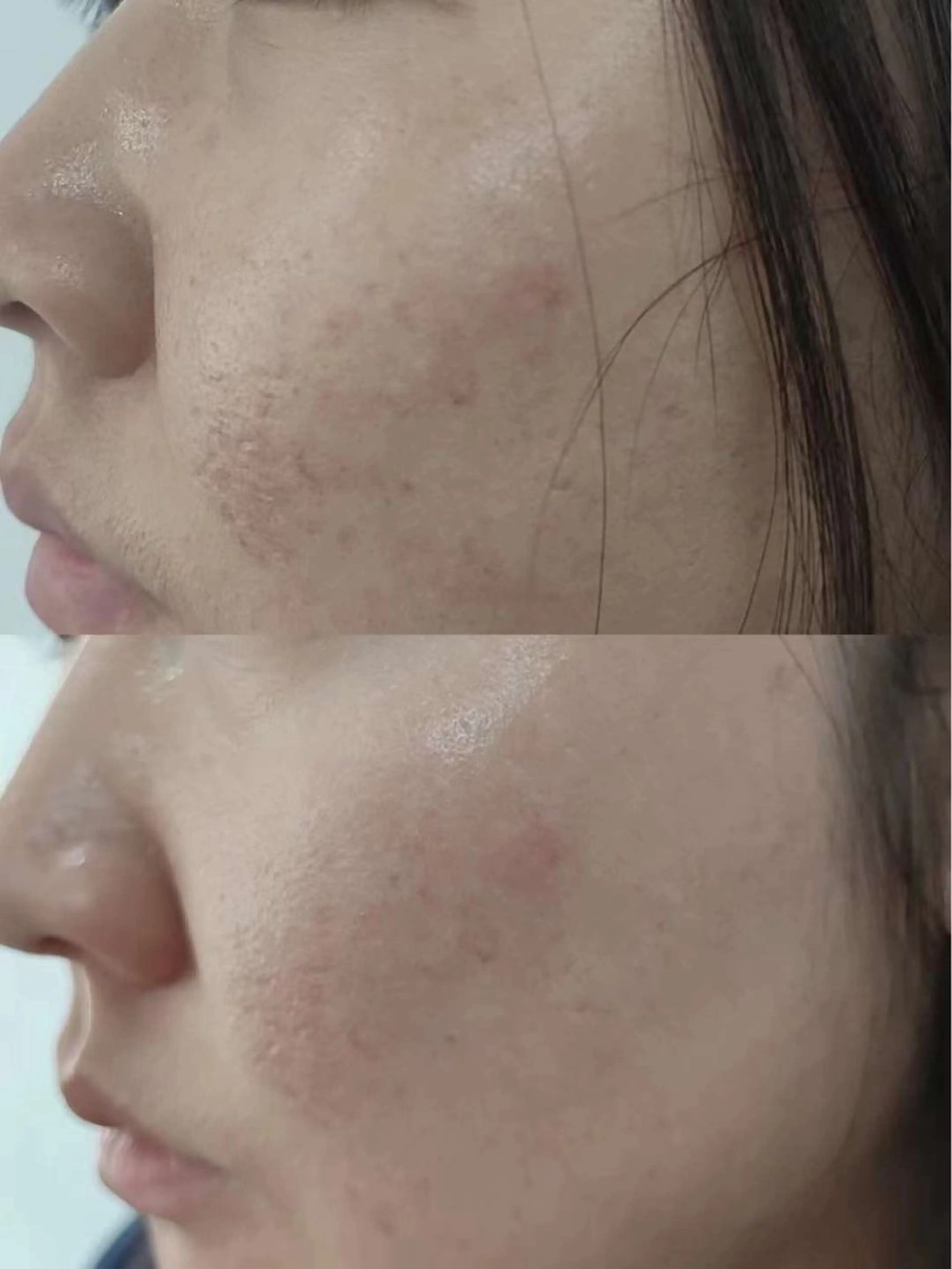 マツエク・マツパ エステ aliaハイフ&水光ジェットサロン所属・aliaハーブ水光店 エステティシャン募集のエステ・リラクイメージ