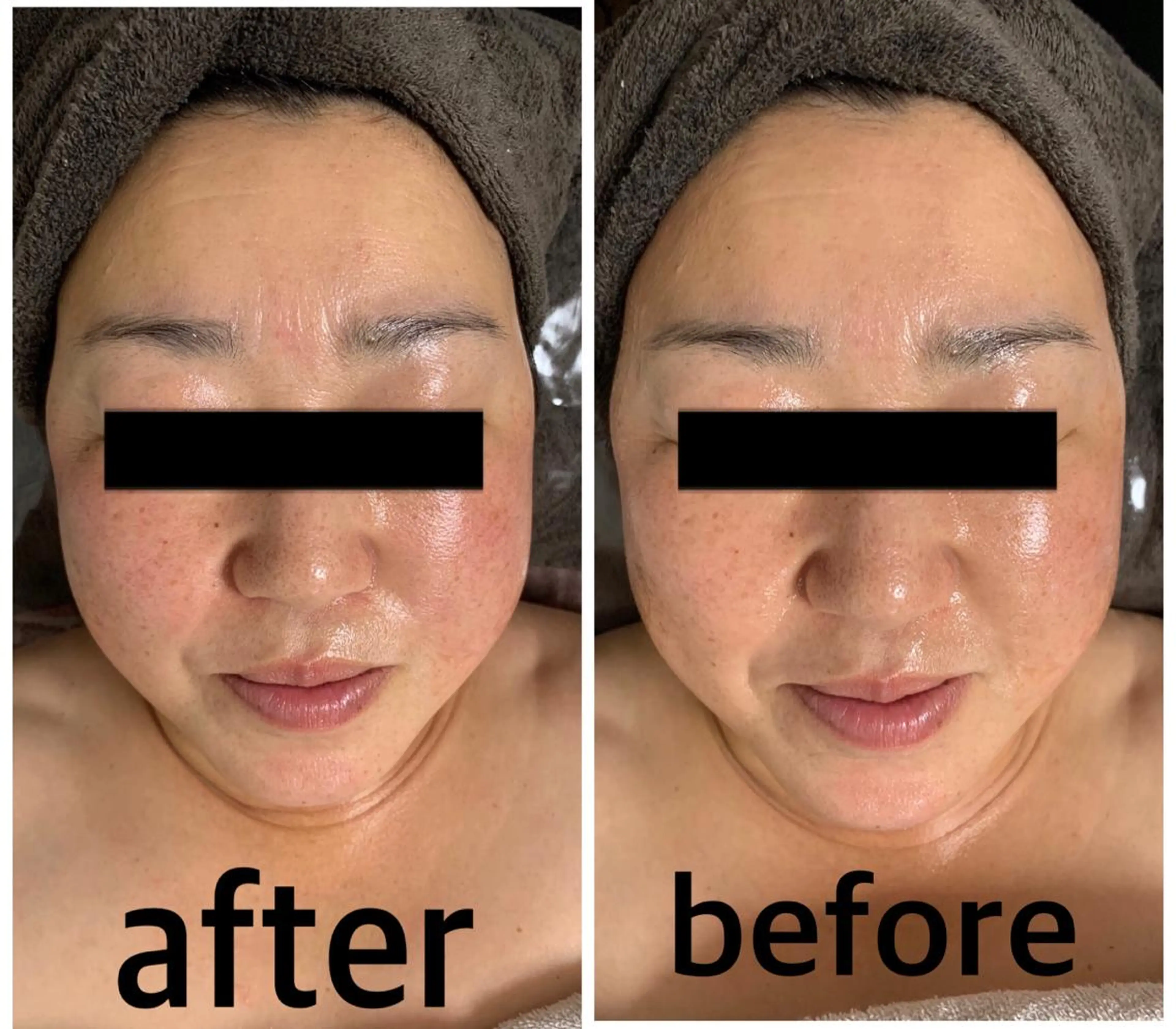 食べながら魅せボディ éclatJua川越のエステ・リラクイメージ