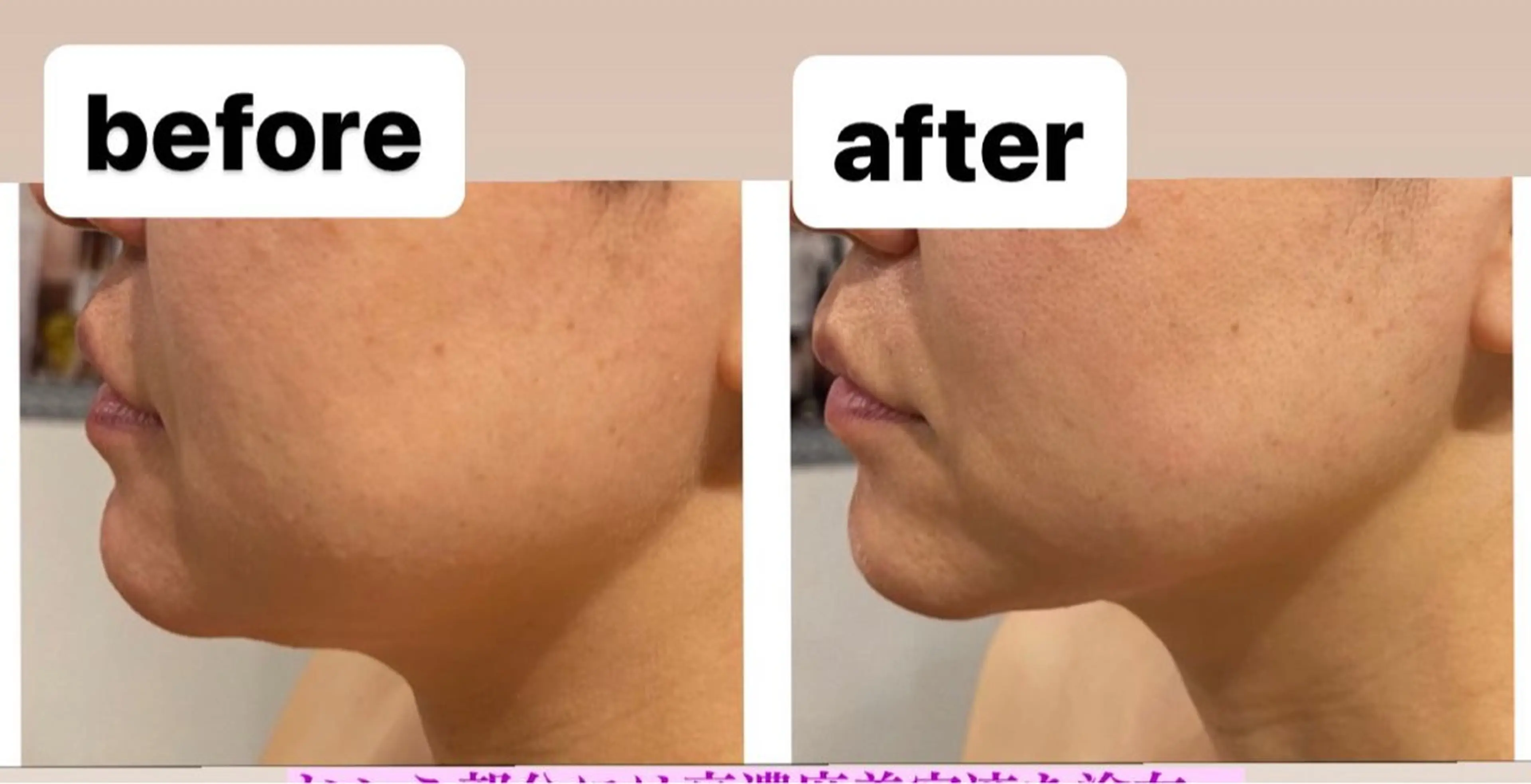 エステ 🅖🅤🅩🅔🅛 salonのエステ・リラクイメージ