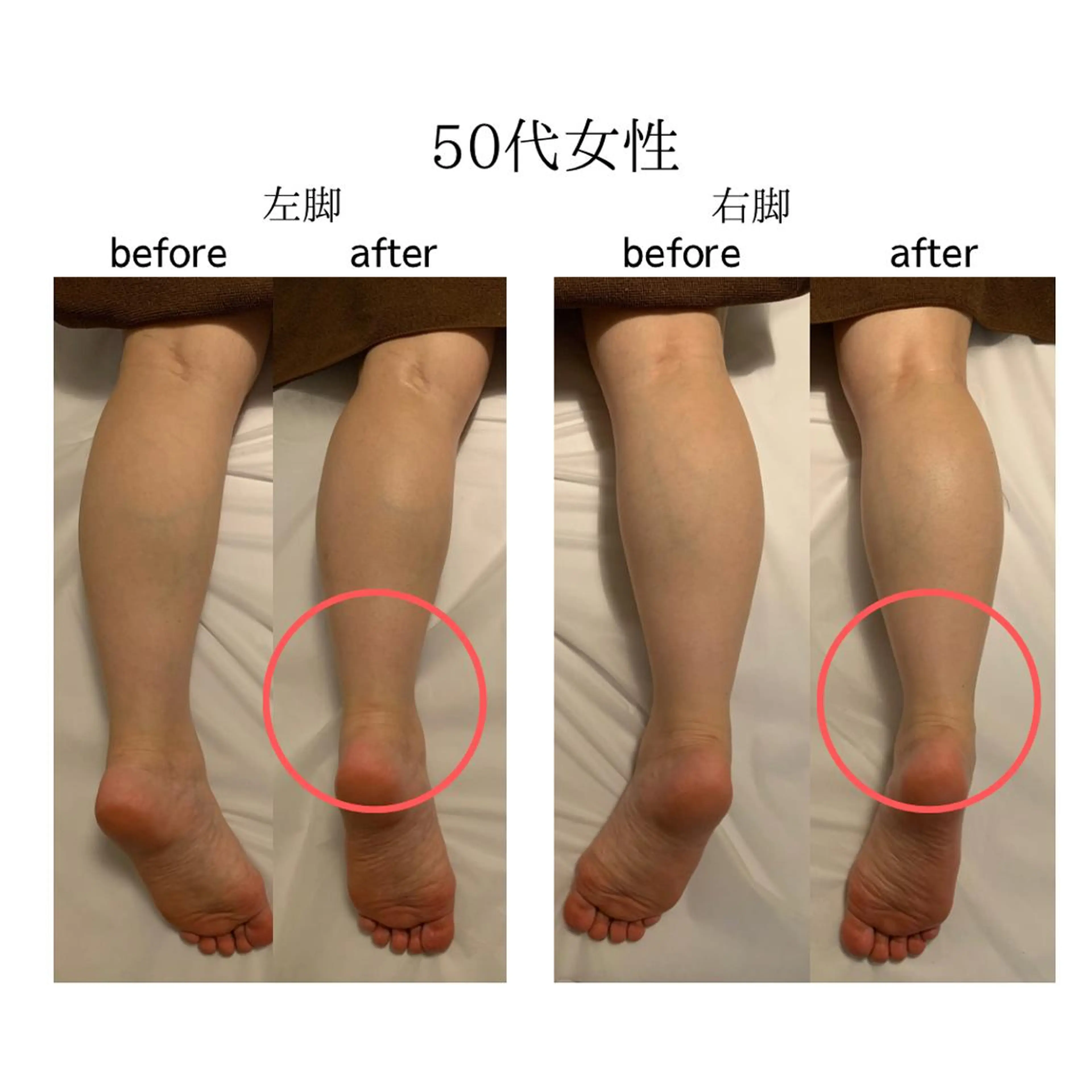 エステ リラク 一坪(ひとツボ)サロンあぷり所属・よもぎ蒸し・腸もみ 石川理沙のエステ・リラクイメージ