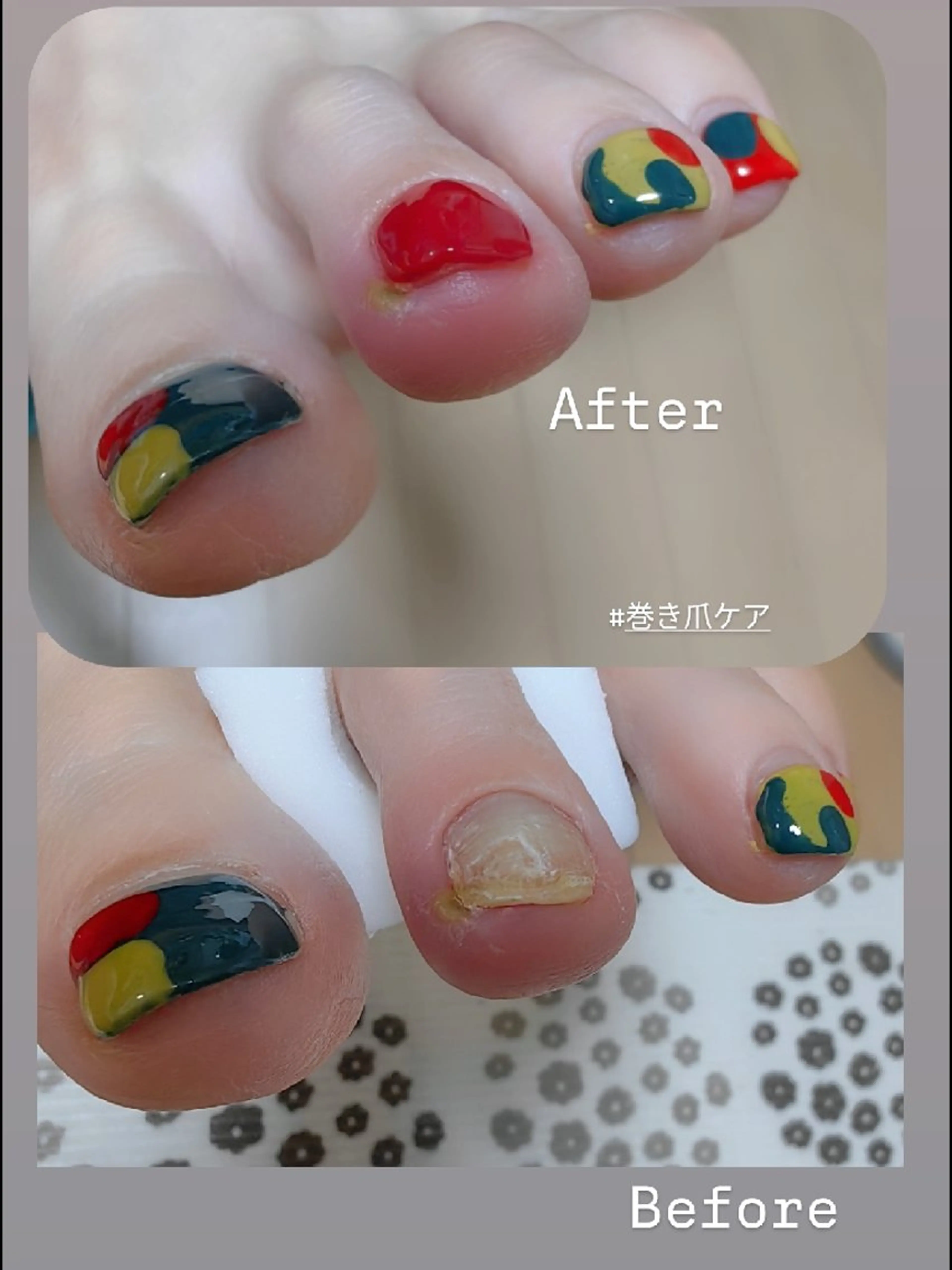 ネイル フットネイル reve あやののネイルデザイン