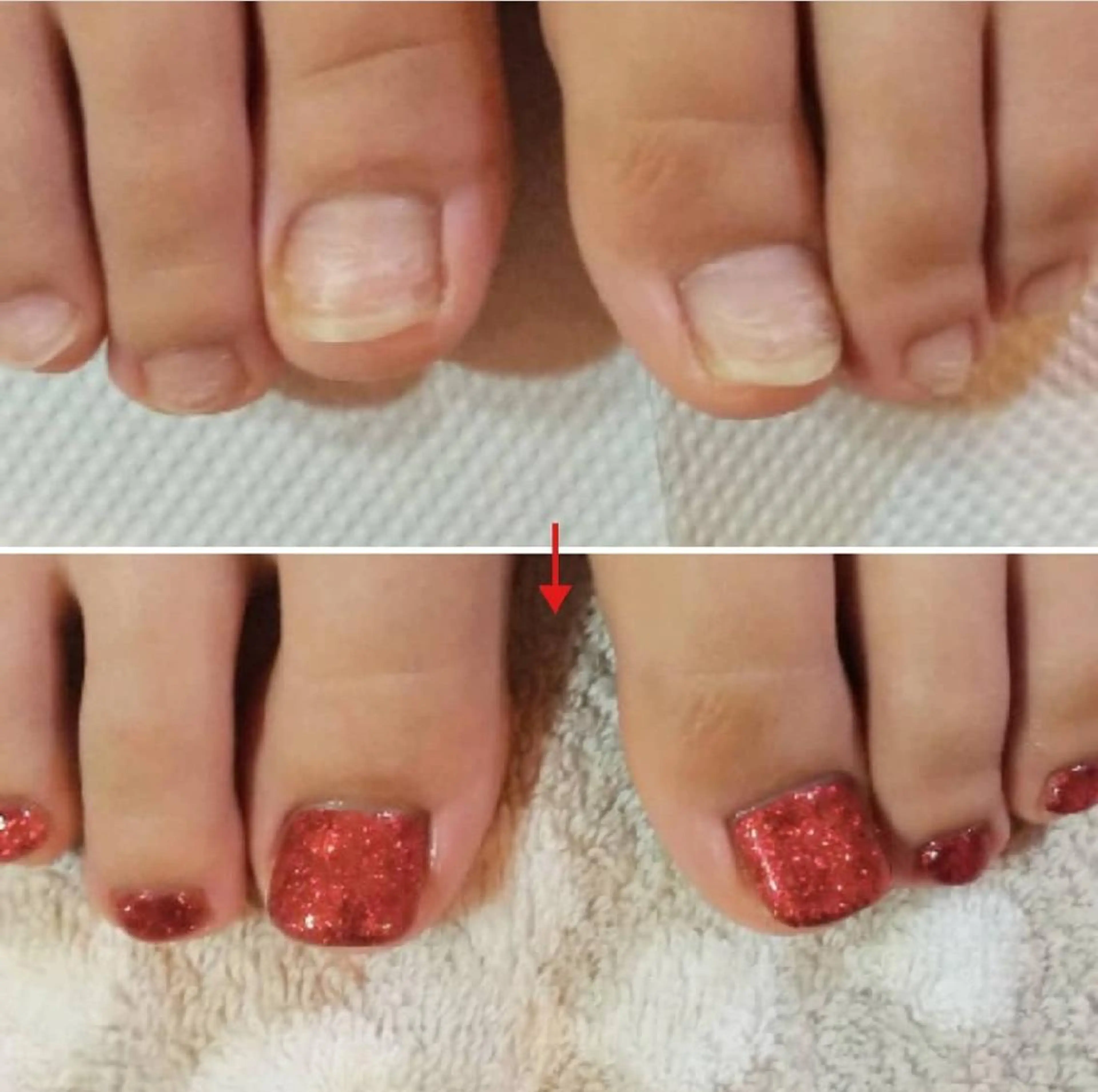 ネイル フットネイル ネイルサロンアリューム所属・ネイルサロン アリュームのネイルデザイン