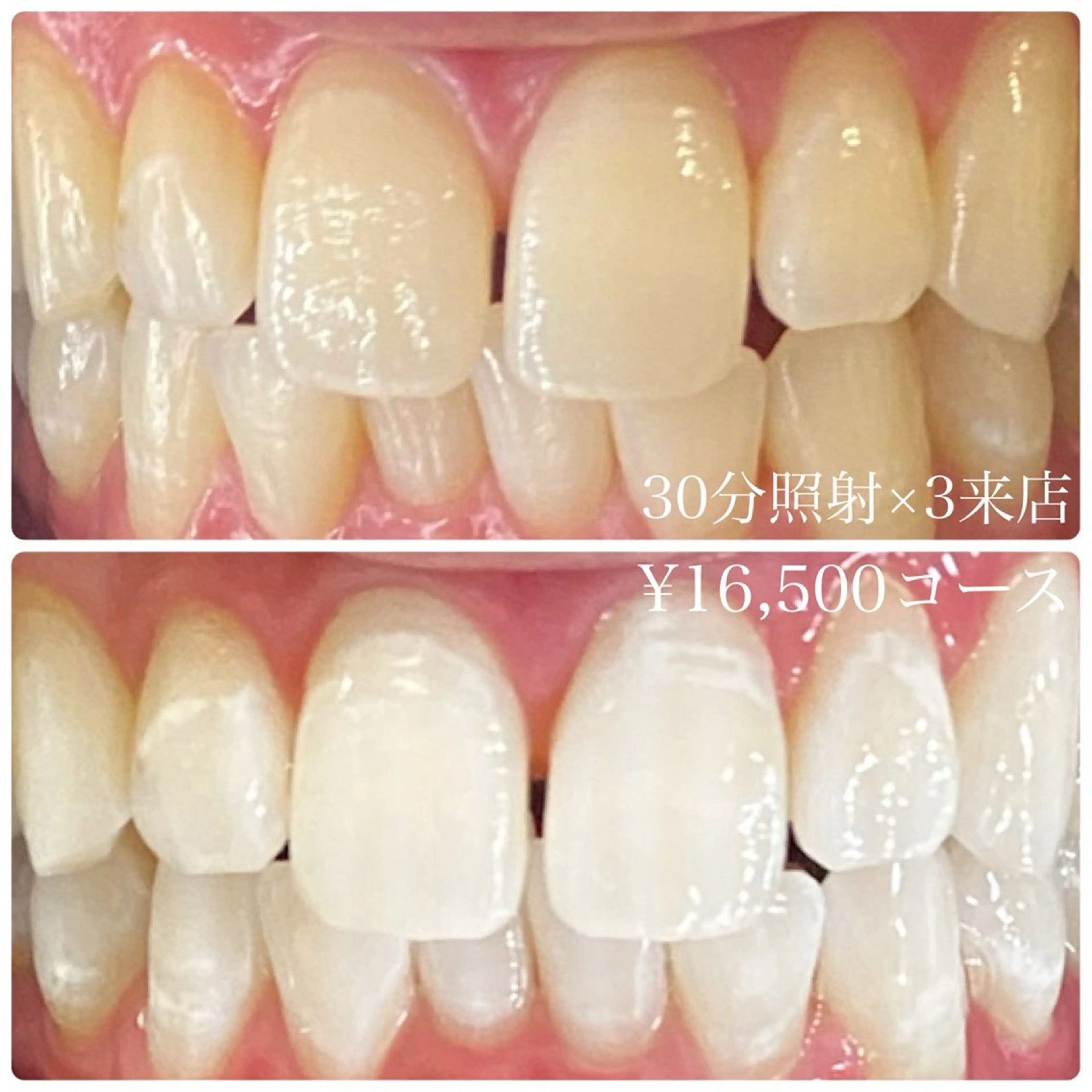 その他 PLATINUM Beauty 横浜店所属・ホワイトニングルーム 横浜店のその他イメージ