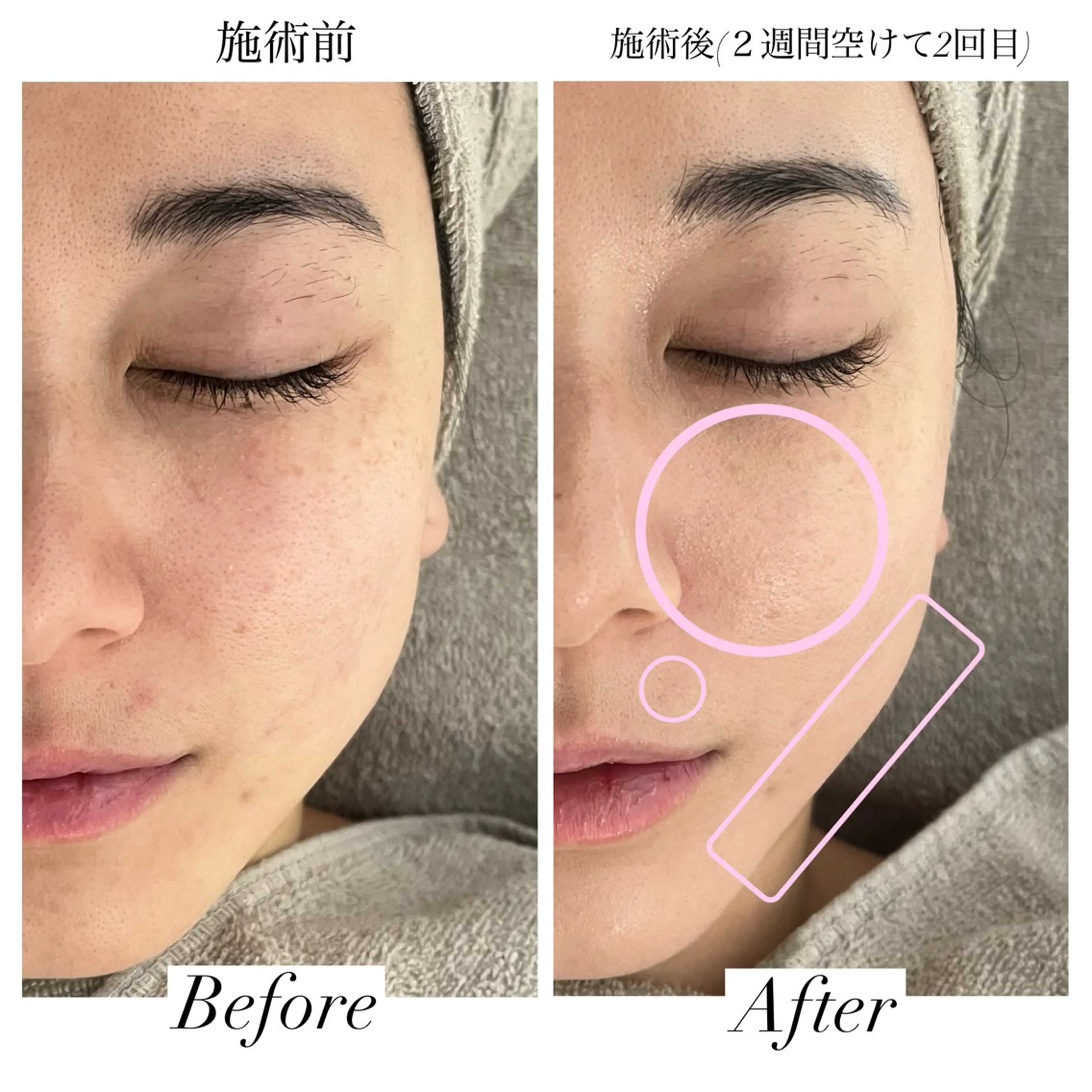 エステ リラク 【Salon D】 HALUのエステ・リラクイメージ