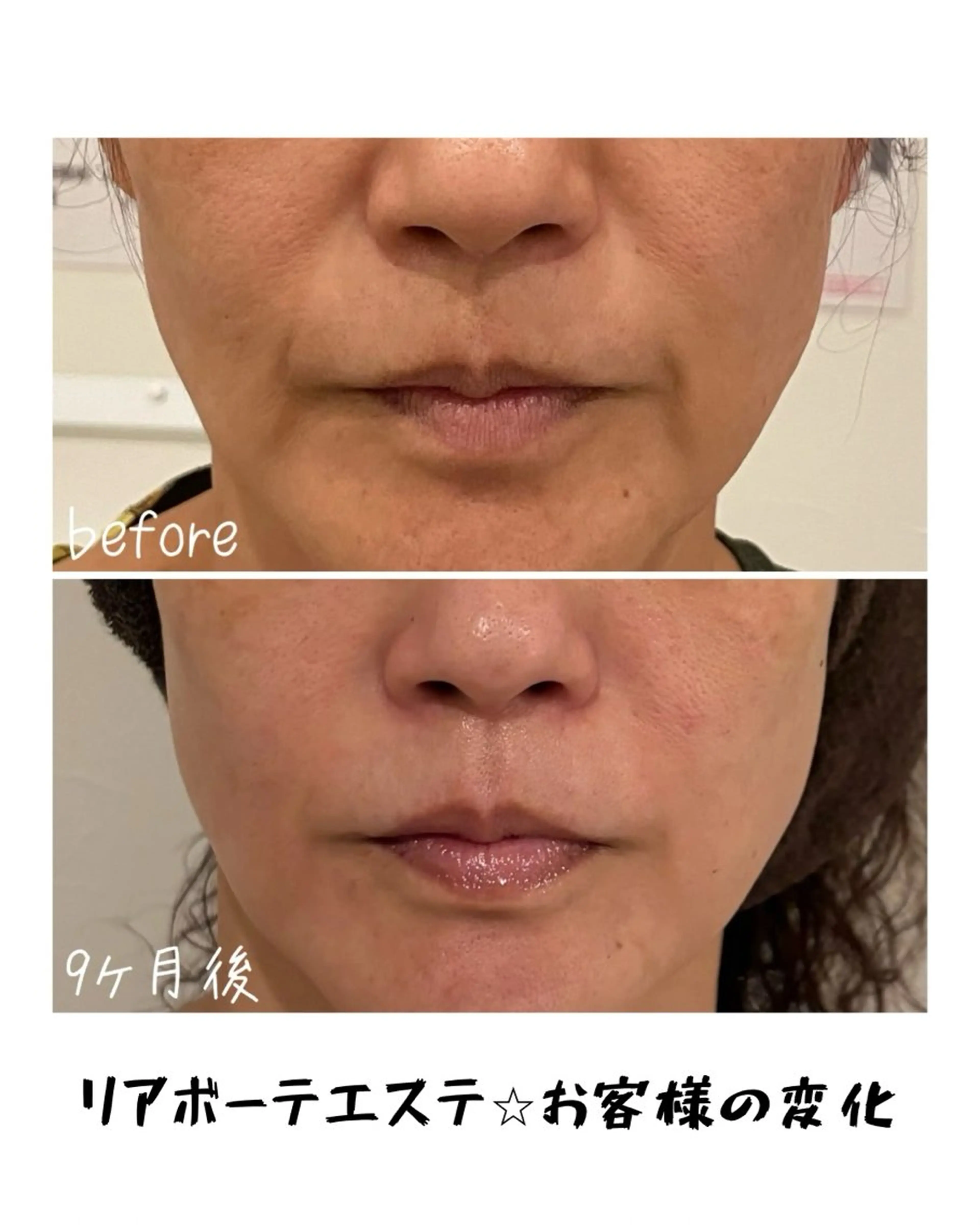 エステ 浜野 恵美のエステ・リラクイメージ