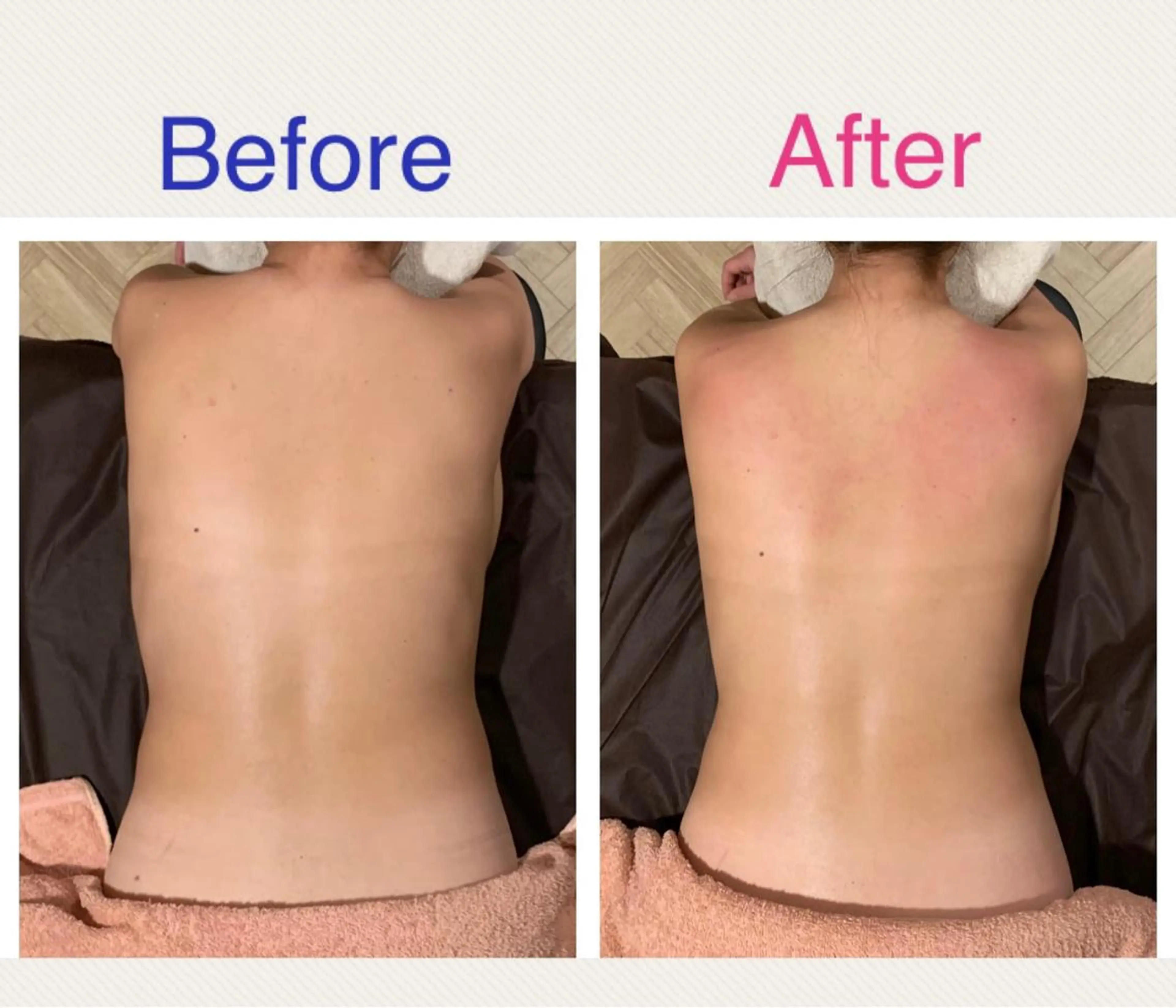 エステ リラク Rewhite -ﾘﾎﾜｲﾄ-のエステ・リラクイメージ