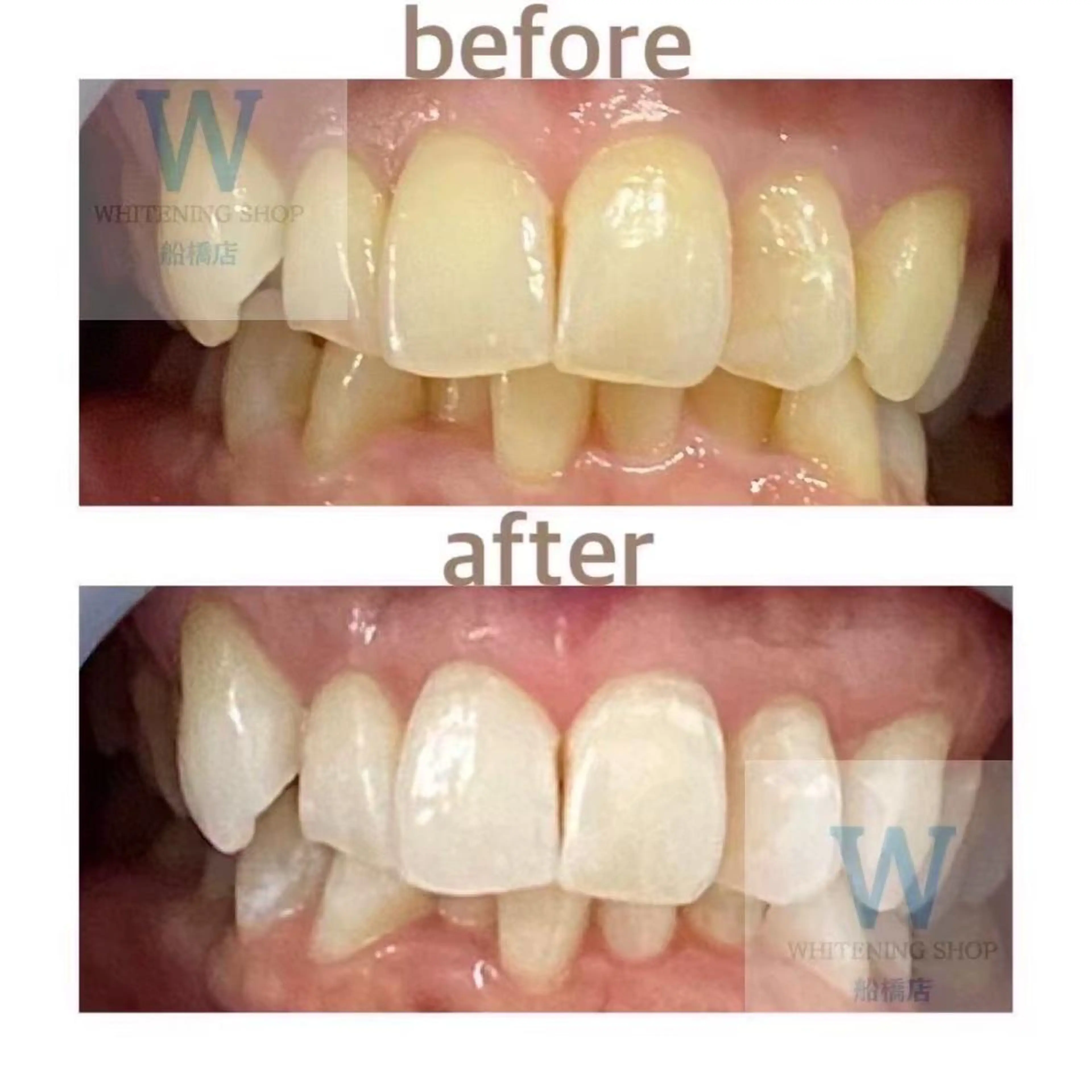 ホワイトニング ショップ船橋2号店のエステ・リラクイメージ