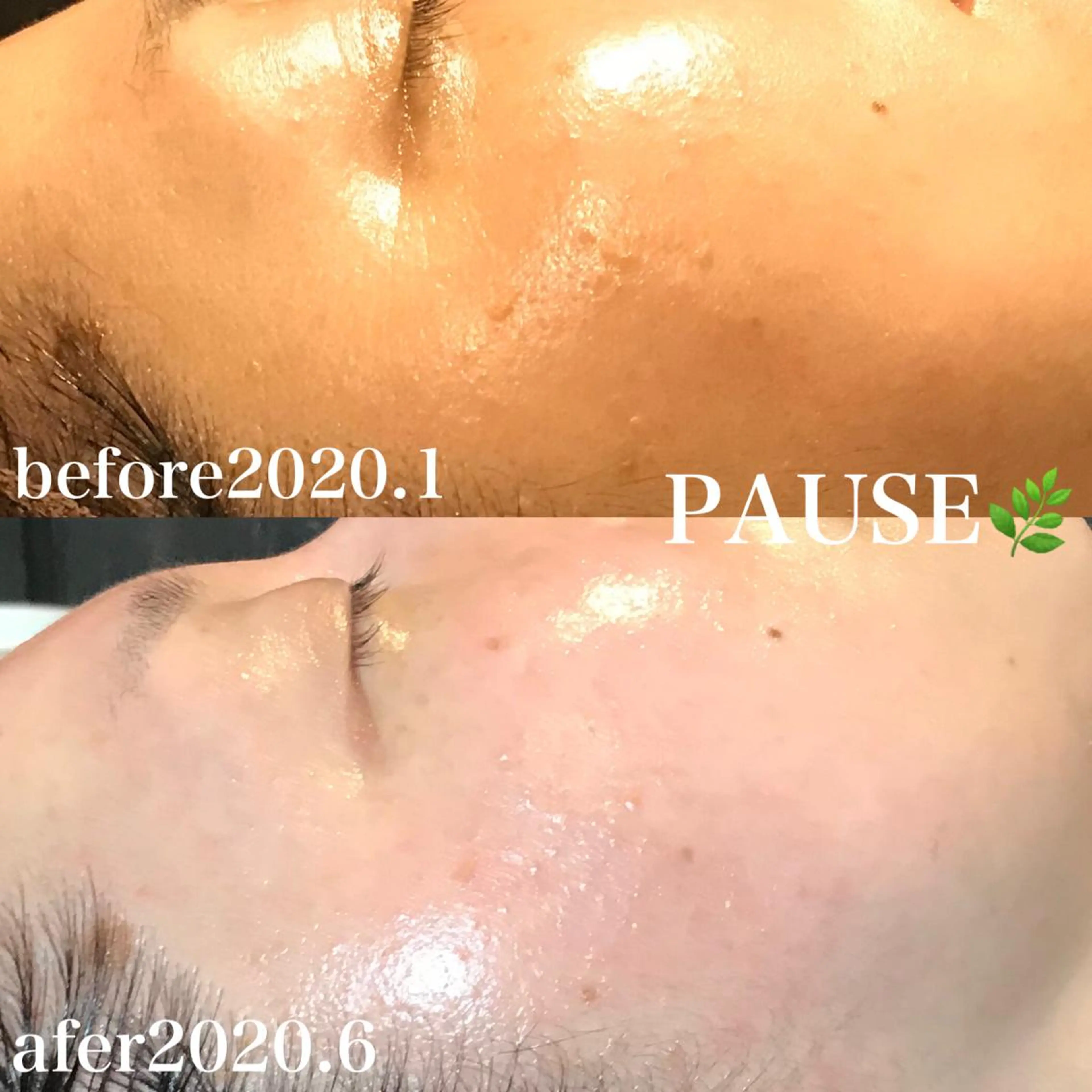 エステ 浜野 恵美のエステ・リラクイメージ