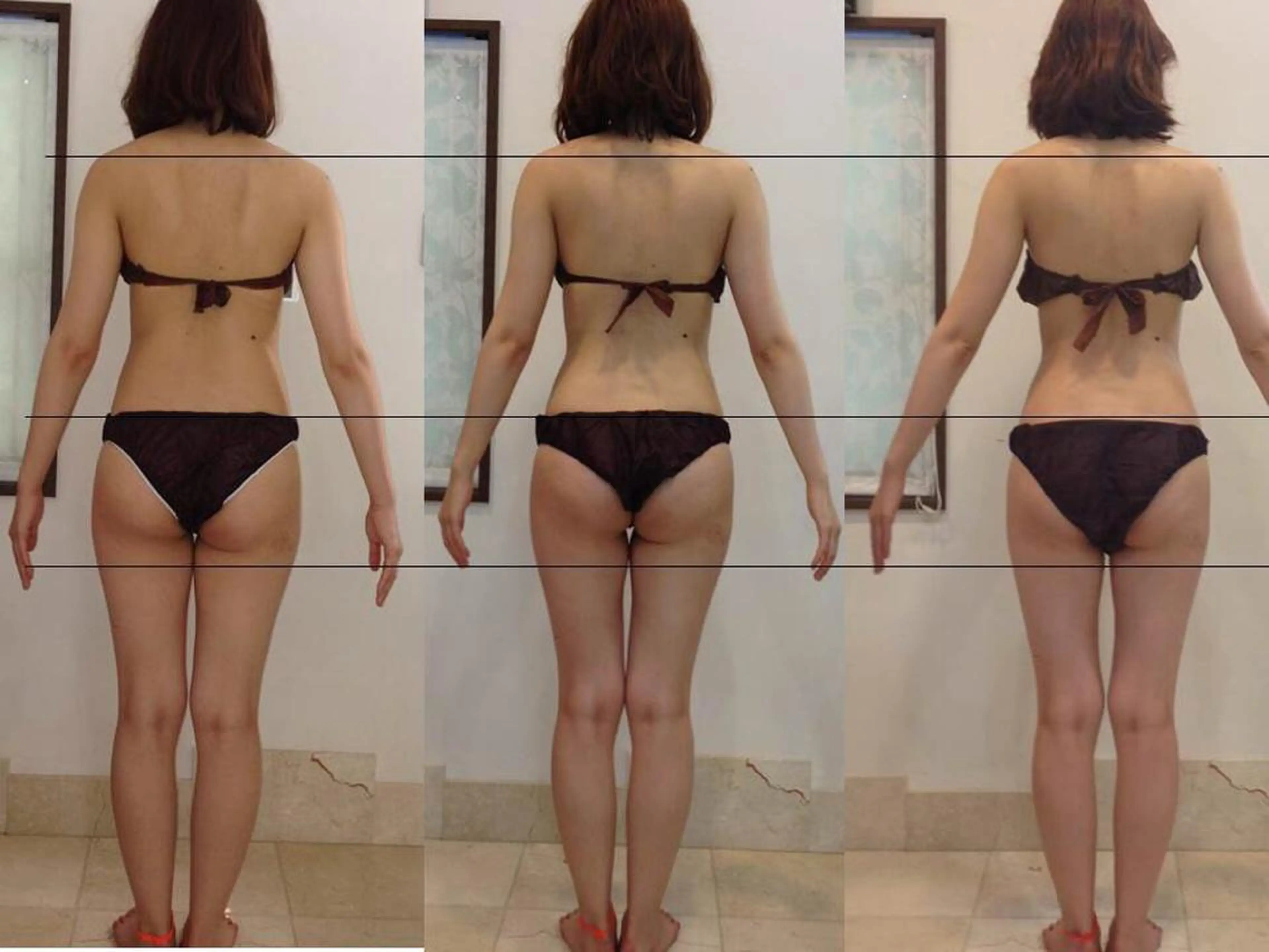 【新規様限定】ハイパーナイフ全身コースの写真