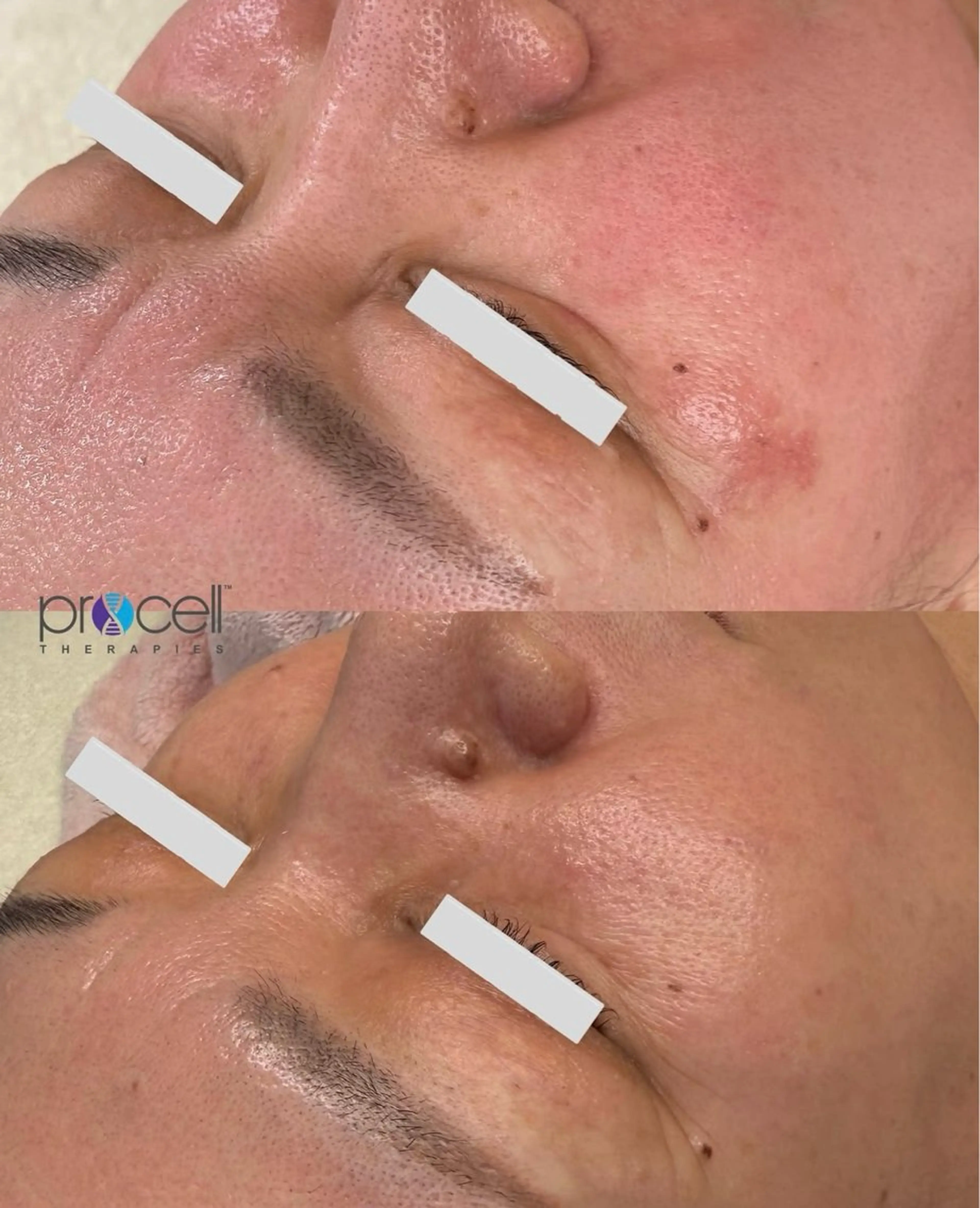 プロセルセラピーズ×肌再生エステの写真