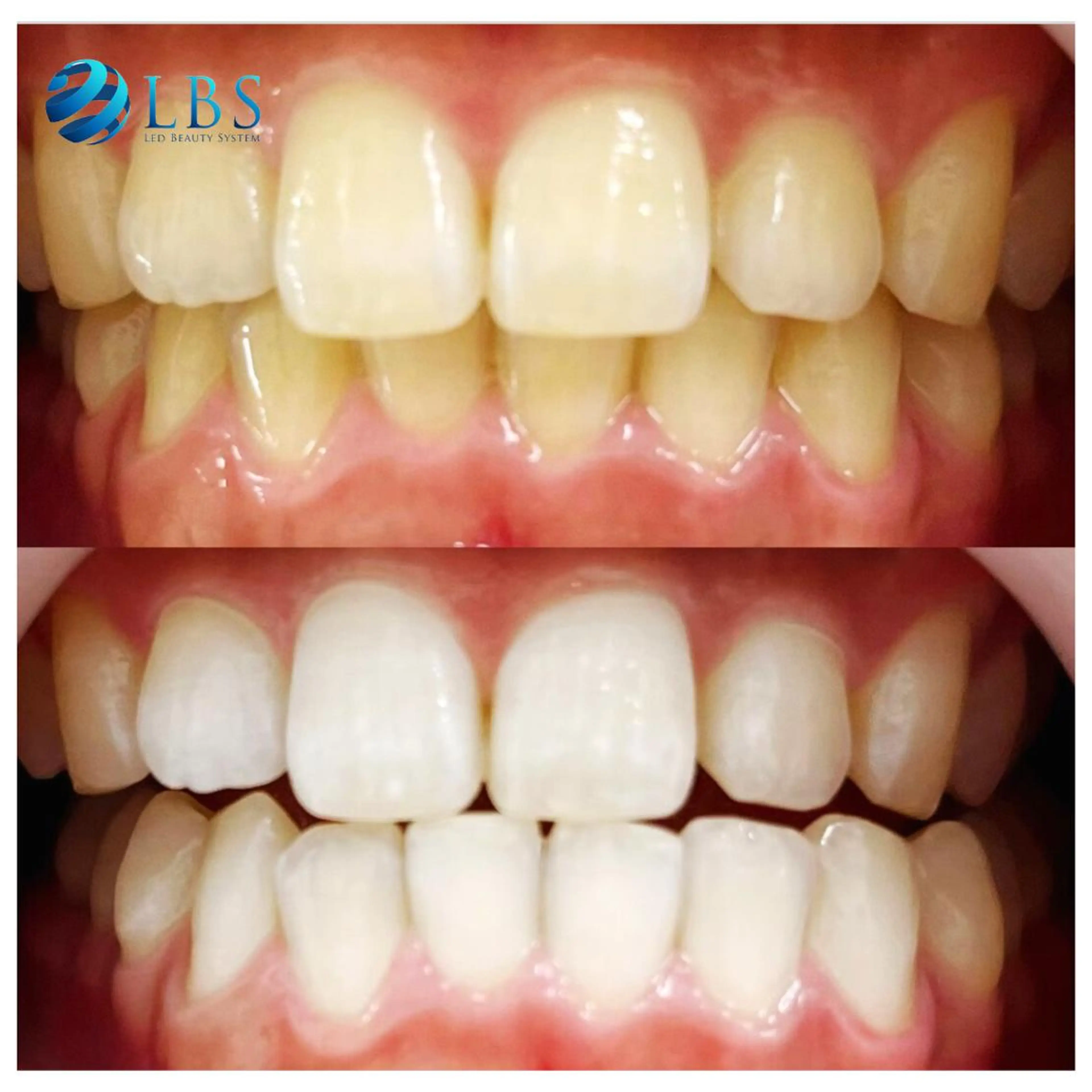 その他 LBSホワイトニング 銀座店💎スタッフ峯のその他イメージ