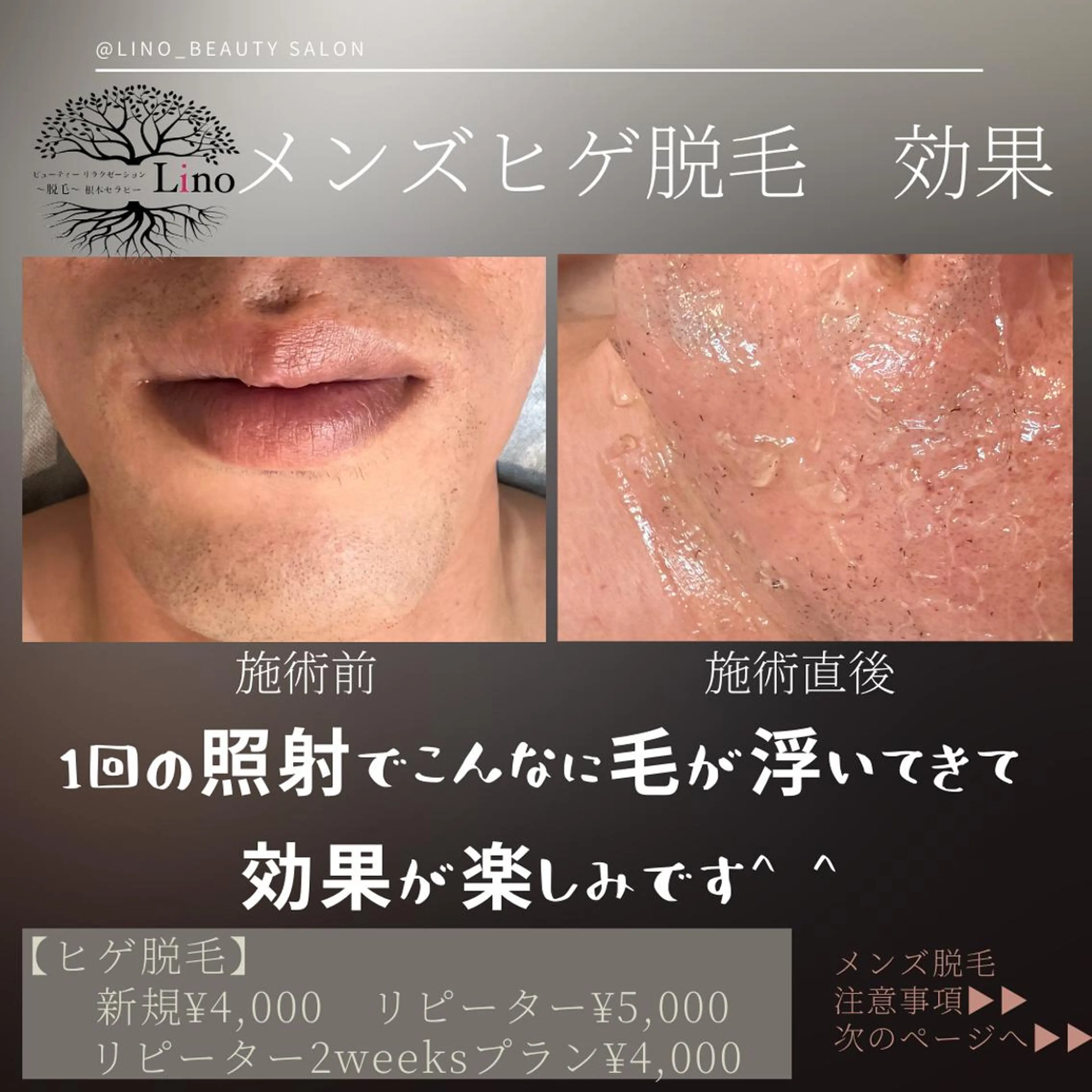 メンズ キッズ ネイル マツエク・マツパ メンズネイル Lino 《リノ》のエステ・リラクイメージ