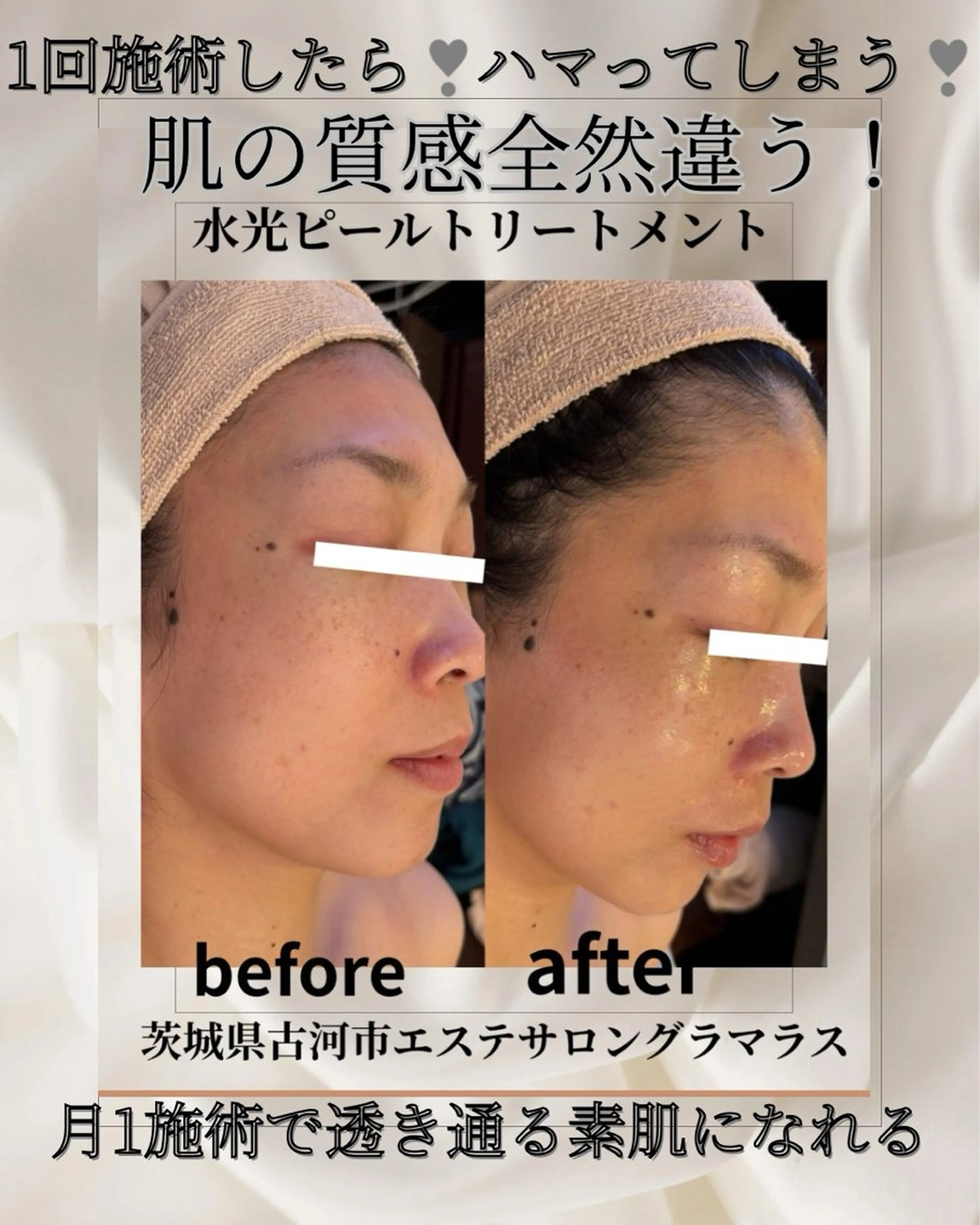 エステ エステサロン グラマラスのエステ・リラクイメージ